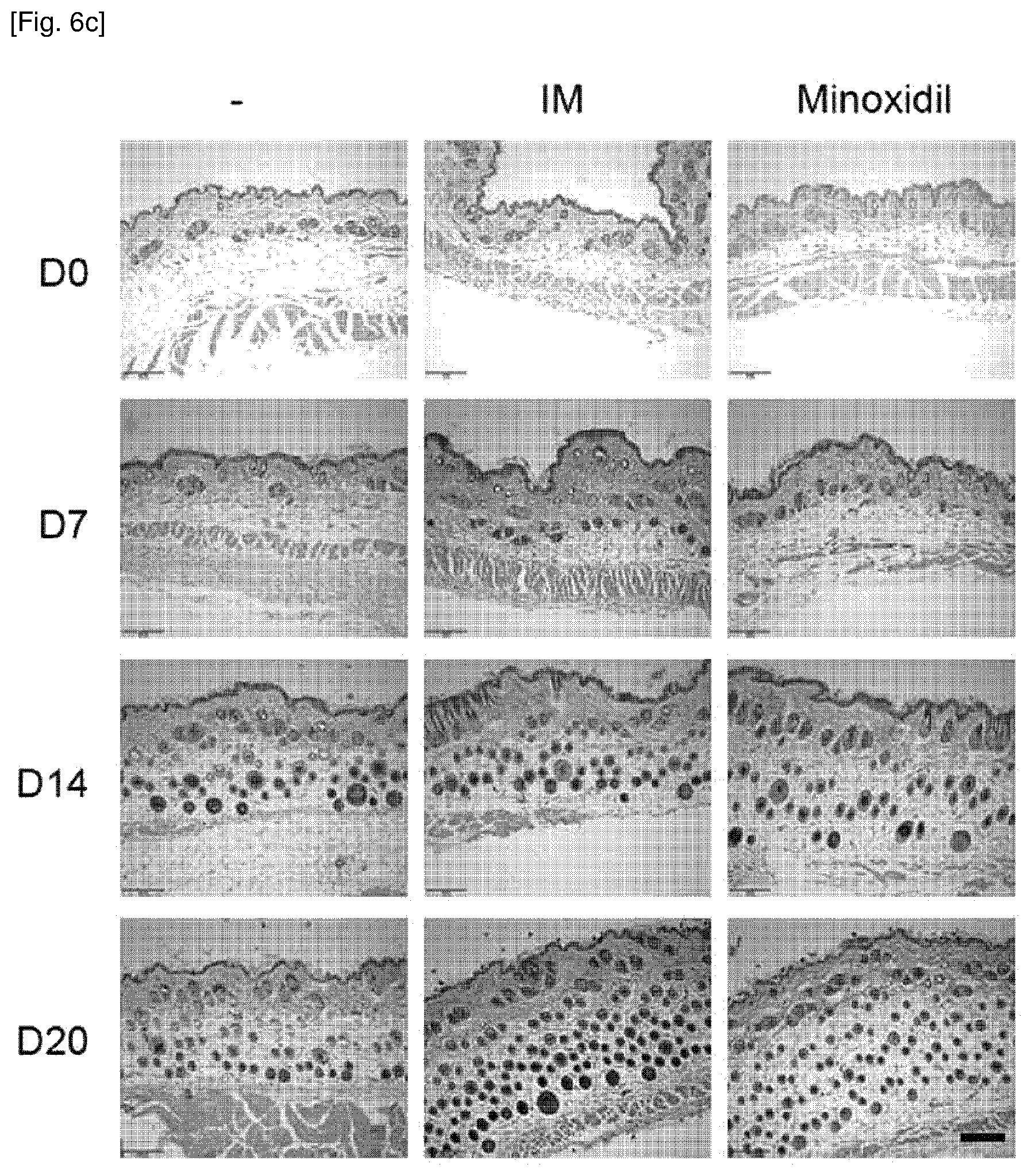 Patent US12377061 Figure 8 – Composition for promoting hair growth comprising a guanine derivative