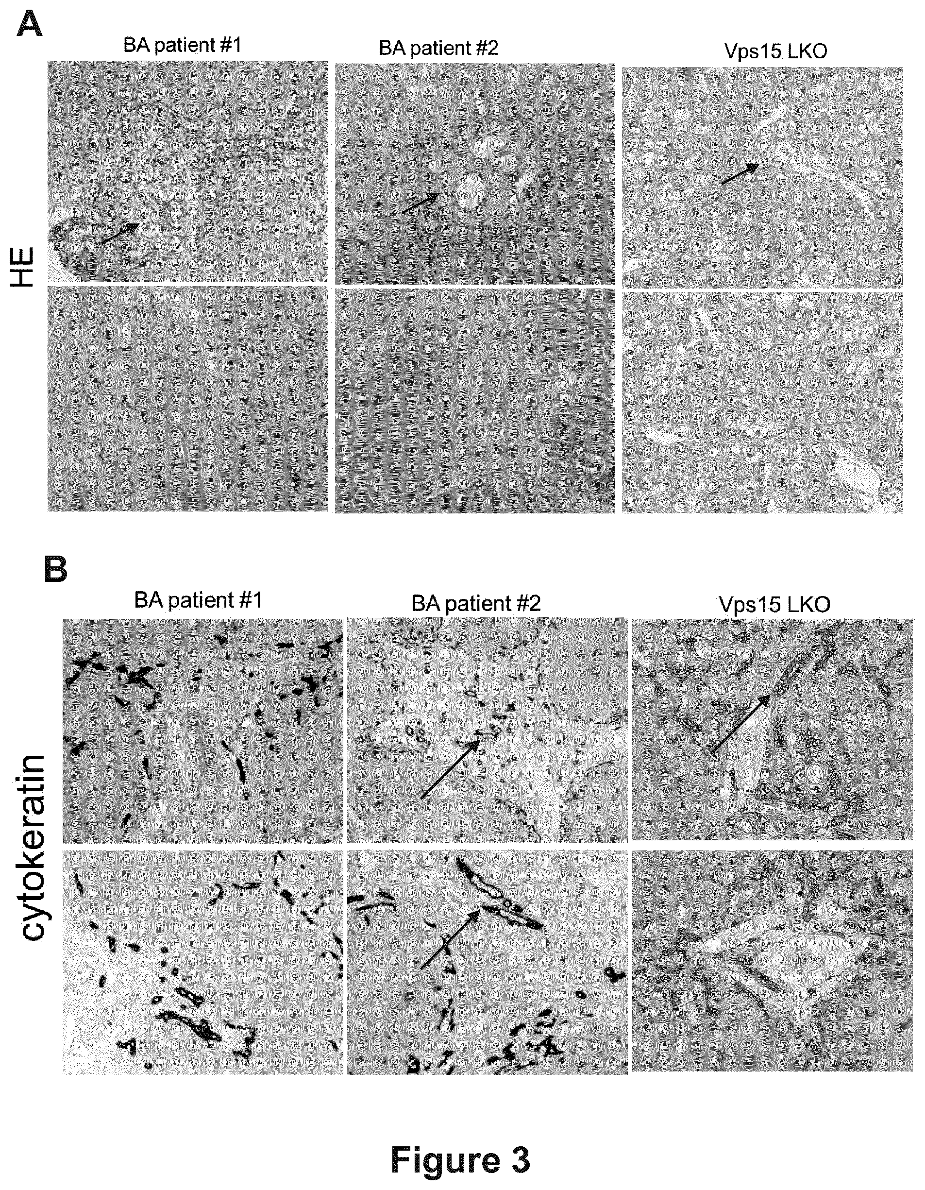 Patent US12377066 Figure 3 – Treatment of diseases associated with biliary system destruction