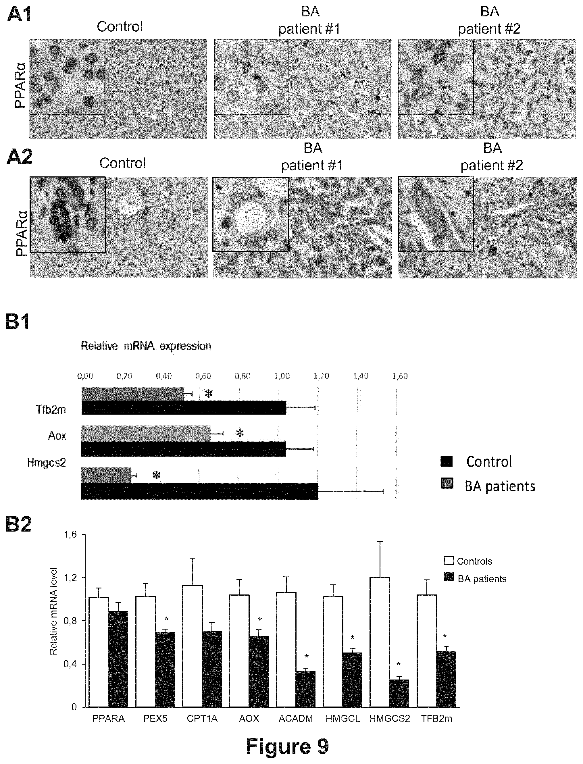 Patent US12377066 Figure 9 – Treatment of diseases associated with biliary system destruction