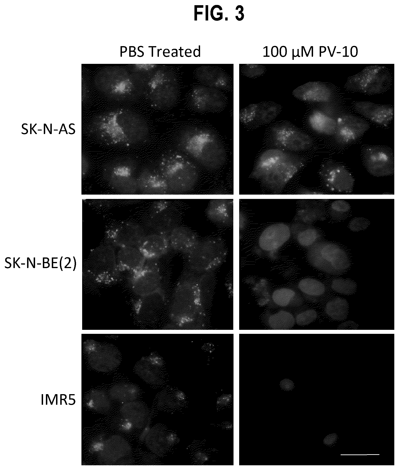 Patent US12377068 Figure 3 – In vitro and xenograft anti-tumor activity of a halogenated-xanthene against refractory pediatric solid tumors