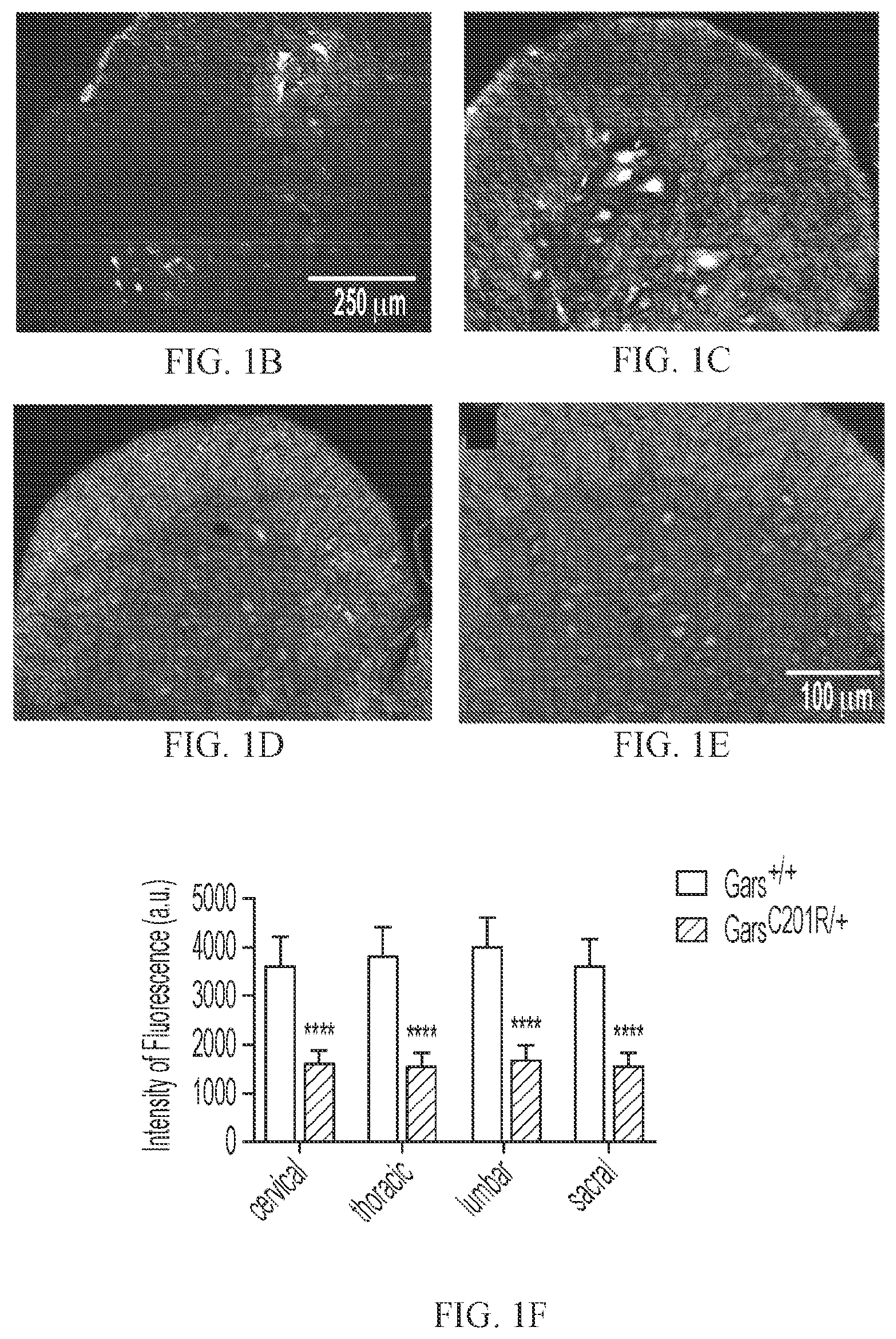 Patent US12377073 Figure 2 – Treatments for charcot-marie-tooth disease