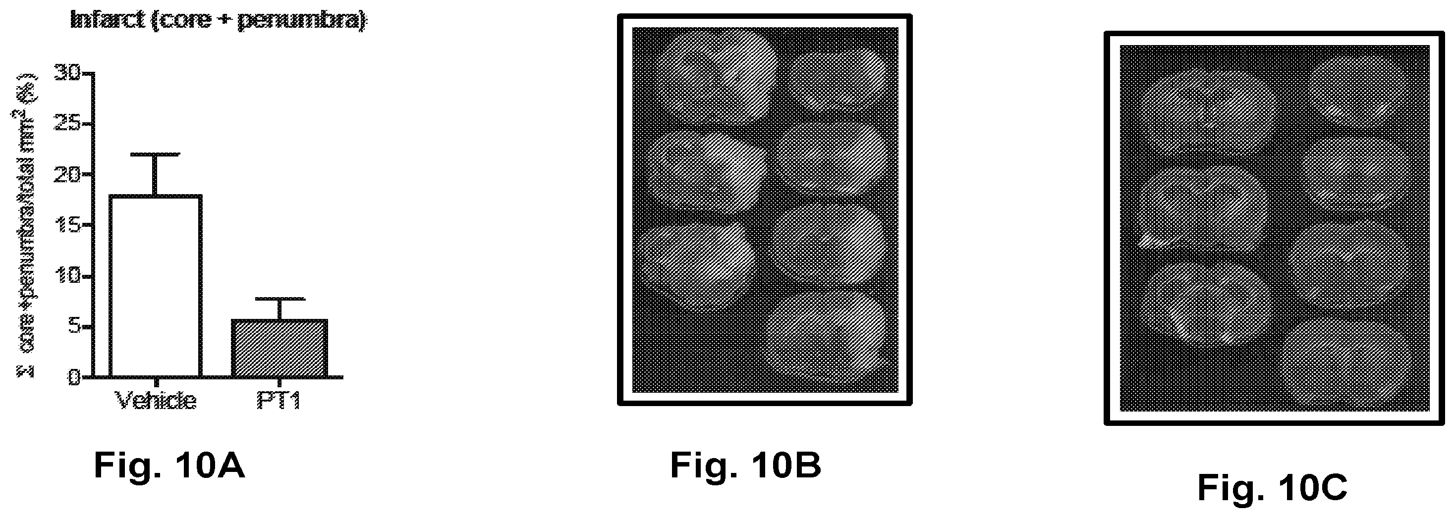 Patent US12377077 Figure 16 – Methods and formulations to treat mitochondrial dysfunction