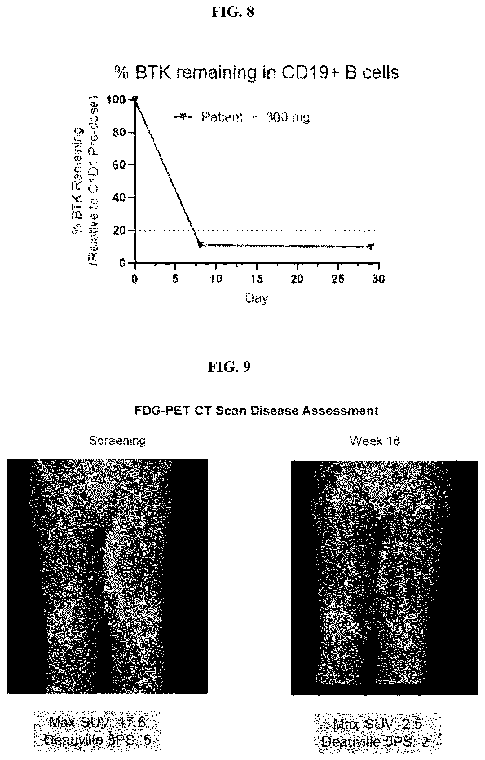 Patent US12377106 Figure 6 – Piperidinylpyrazine-carboxamide compounds for treating and preventing cancer and for degrading BTK