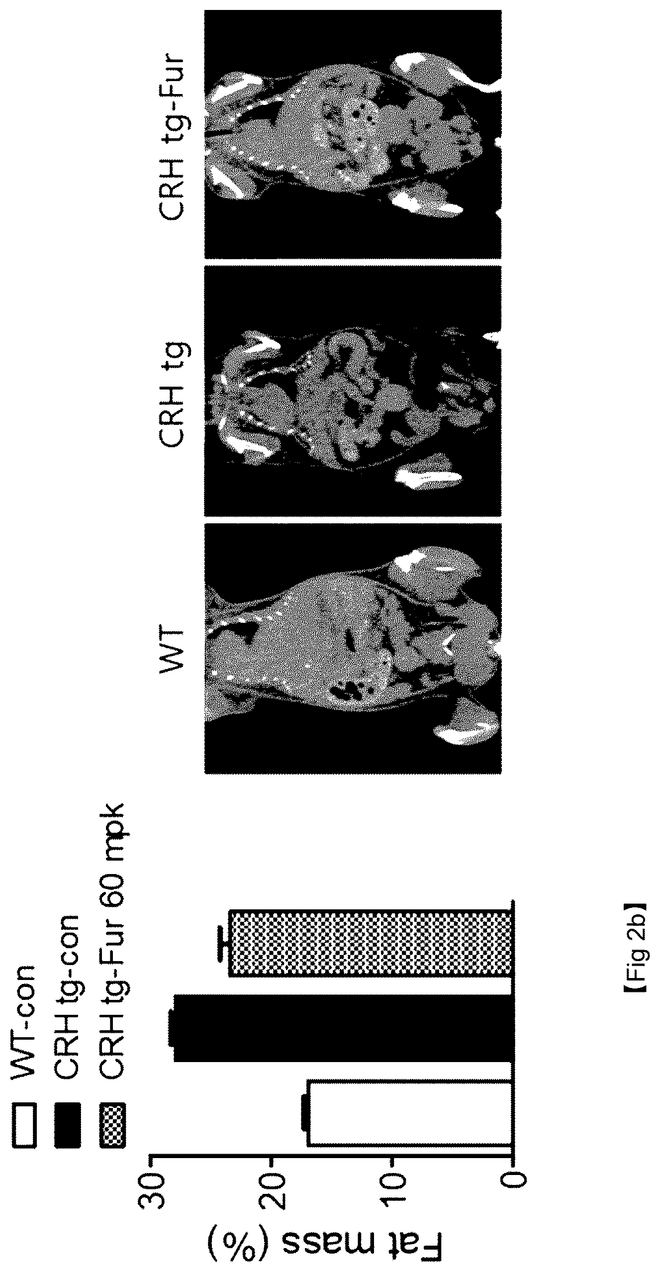 Patent US12377111 Figure 5 – Composition, comprising thiamine derivative, for prevention or treatment of hypercortisolemia