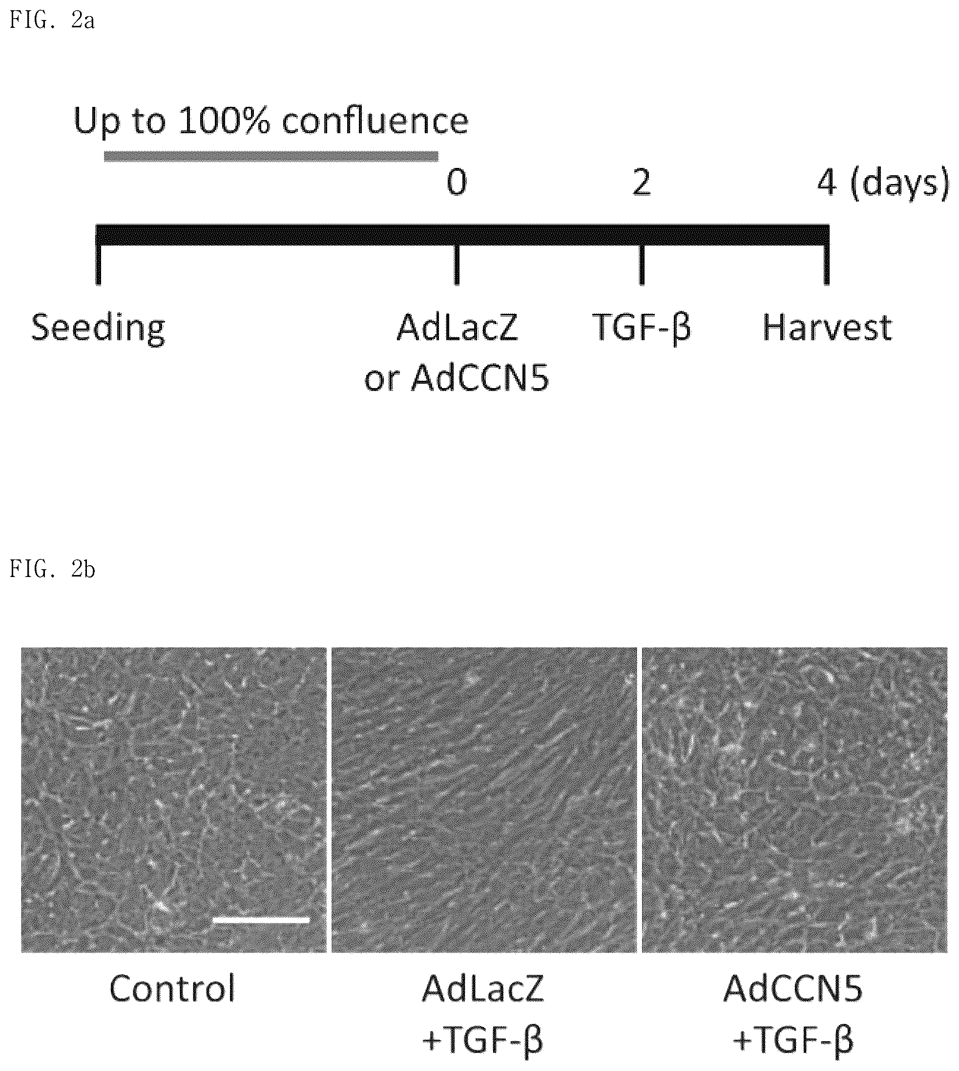 Patent US12377130 Figure 4 – Pharmaceutical composition comprising CCN5 as active ingredient, for preventing or treating retinal diseases