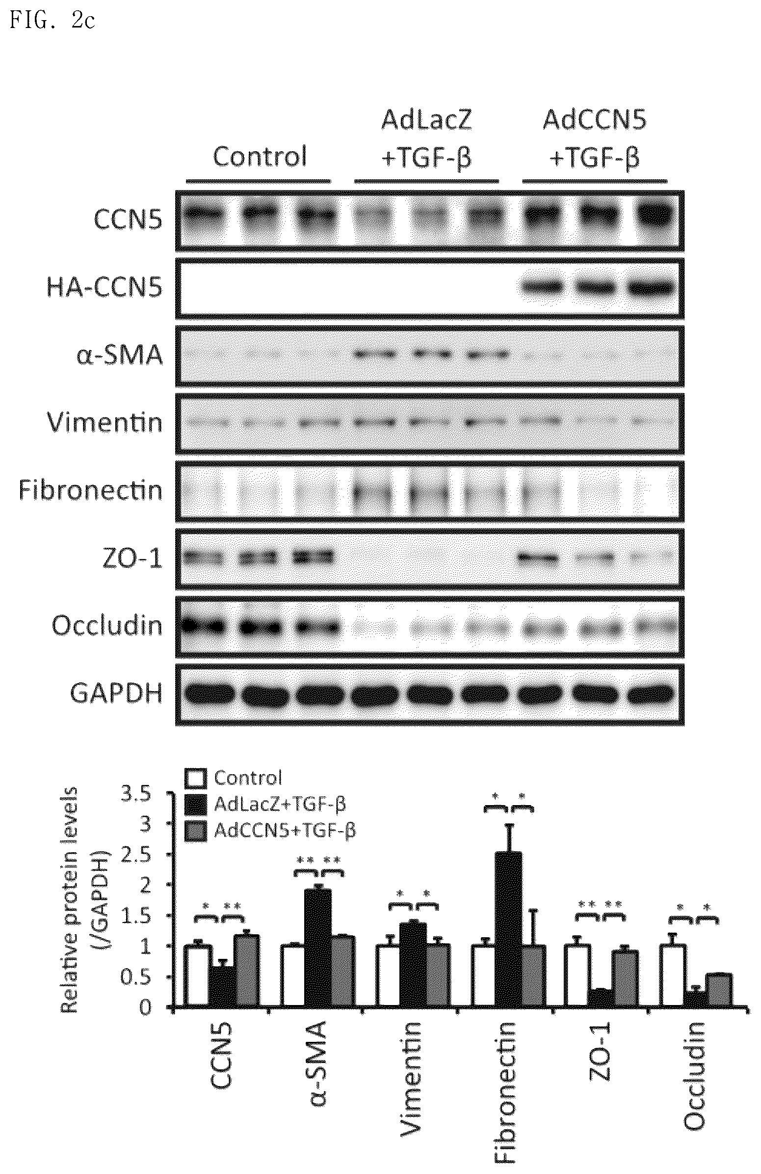 Patent US12377130 Figure 5 – Pharmaceutical composition comprising CCN5 as active ingredient, for preventing or treating retinal diseases