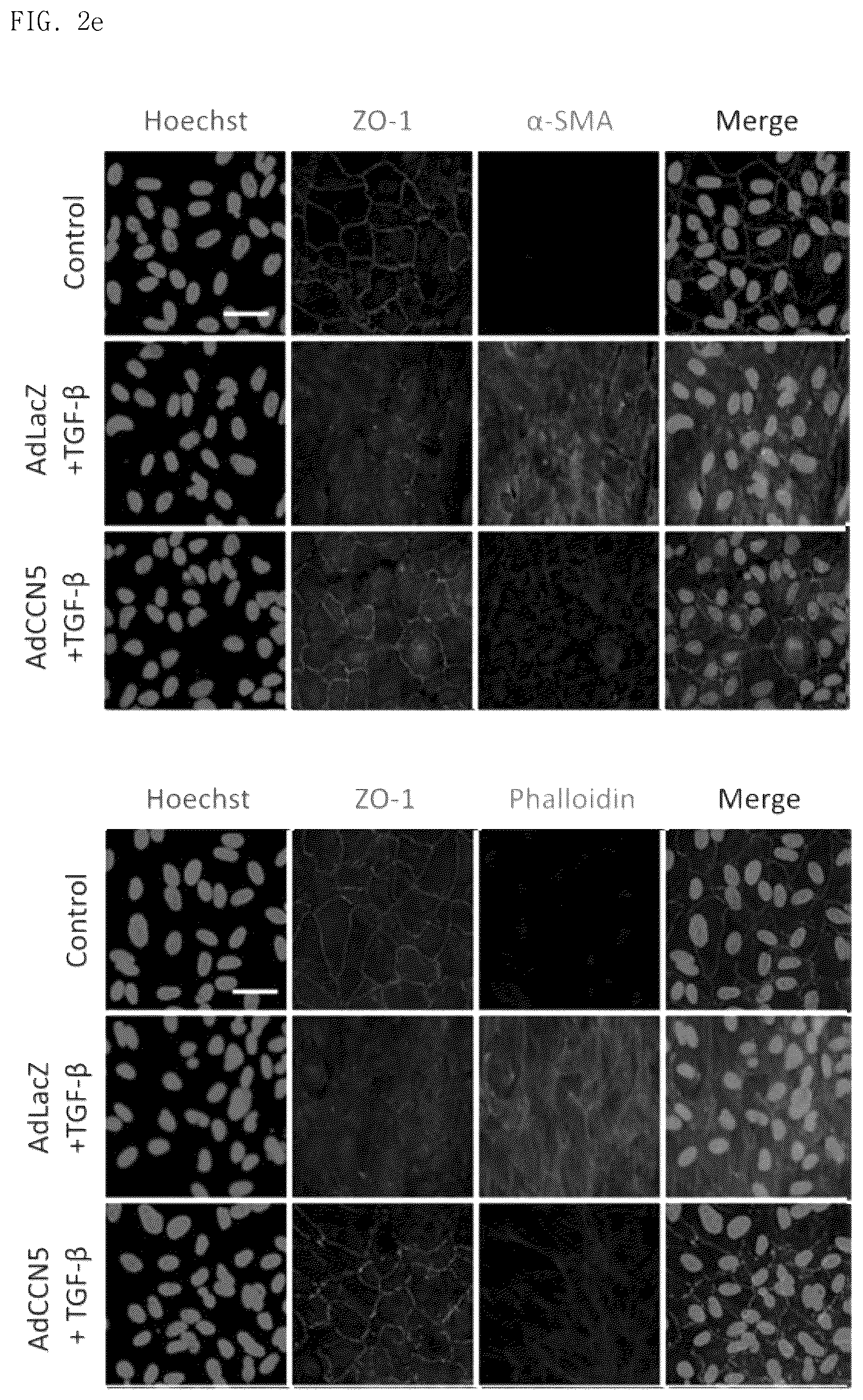 Patent US12377130 Figure 7 – Pharmaceutical composition comprising CCN5 as active ingredient, for preventing or treating retinal diseases