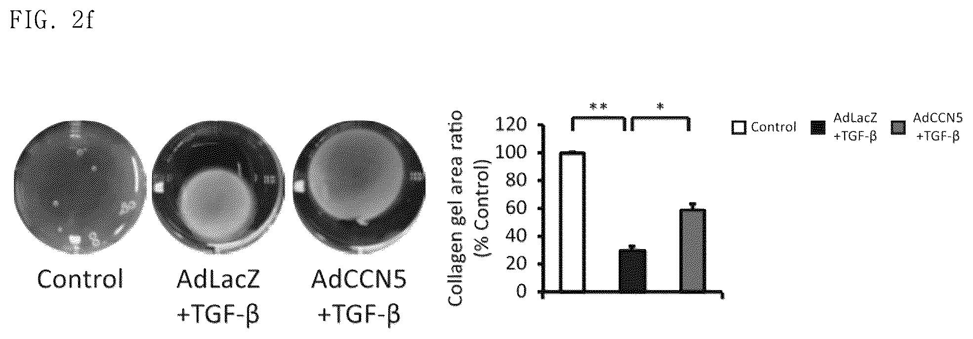 Patent US12377130 Figure 8 – Pharmaceutical composition comprising CCN5 as active ingredient, for preventing or treating retinal diseases