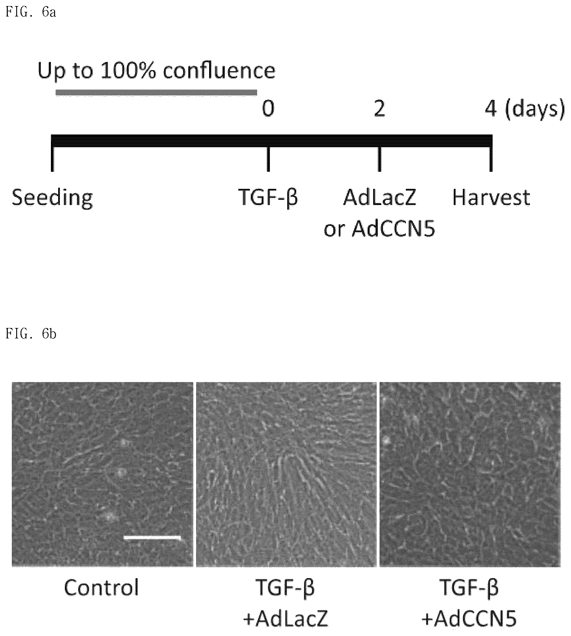 Patent US12377130 Figure 14 – Pharmaceutical composition comprising CCN5 as active ingredient, for preventing or treating retinal diseases