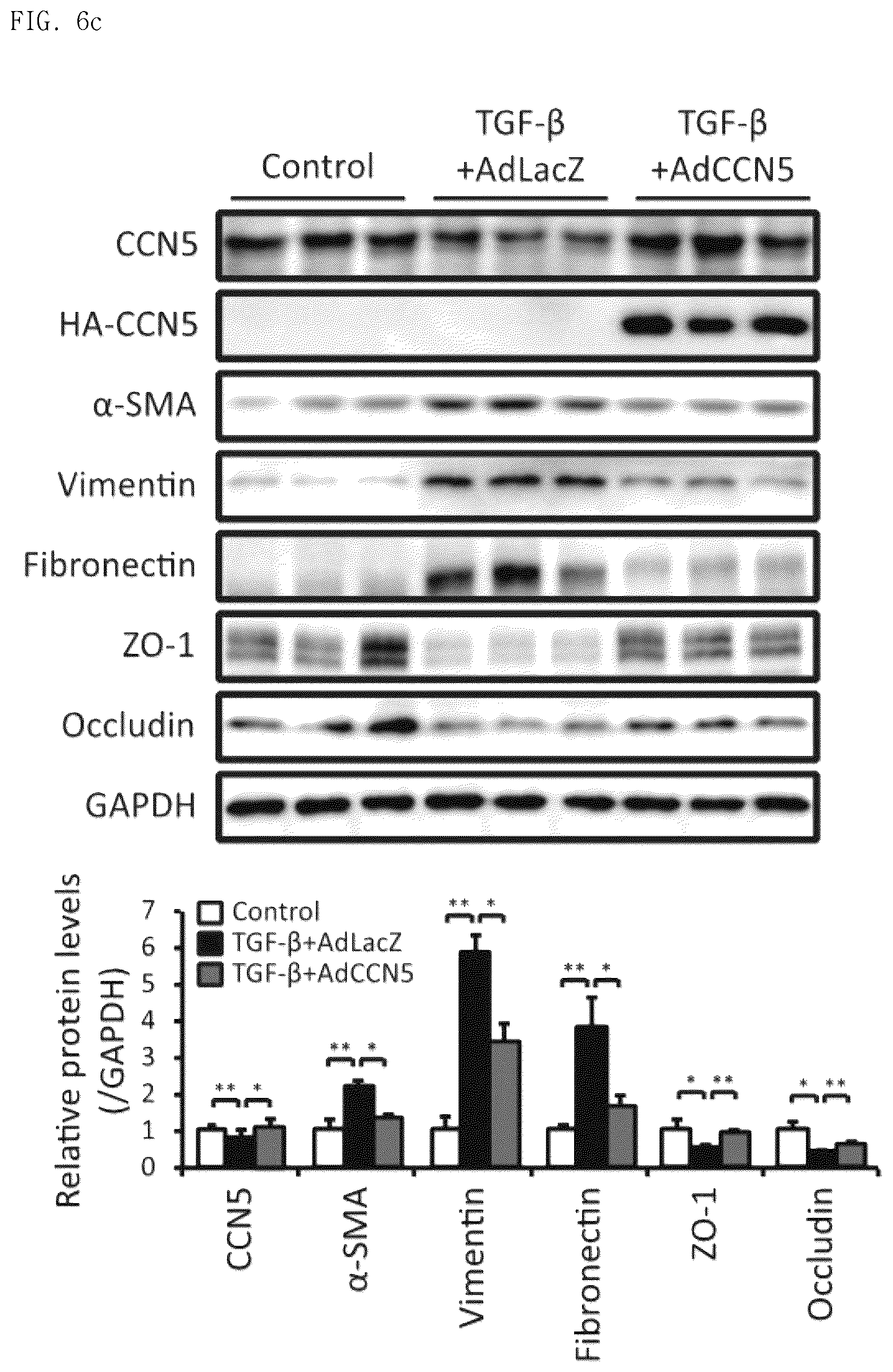 Patent US12377130 Figure 15 – Pharmaceutical composition comprising CCN5 as active ingredient, for preventing or treating retinal diseases