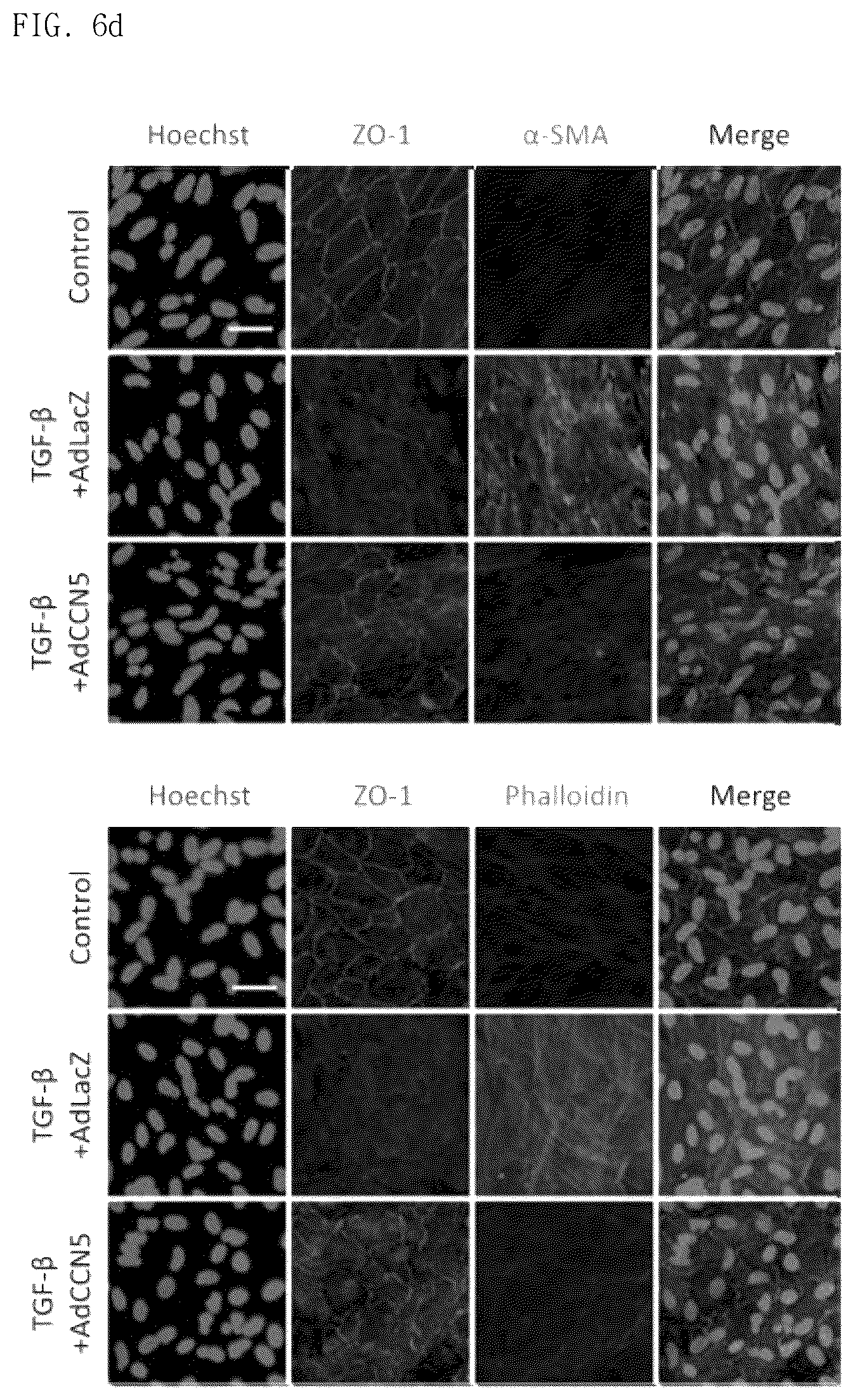 Patent US12377130 Figure 16 – Pharmaceutical composition comprising CCN5 as active ingredient, for preventing or treating retinal diseases