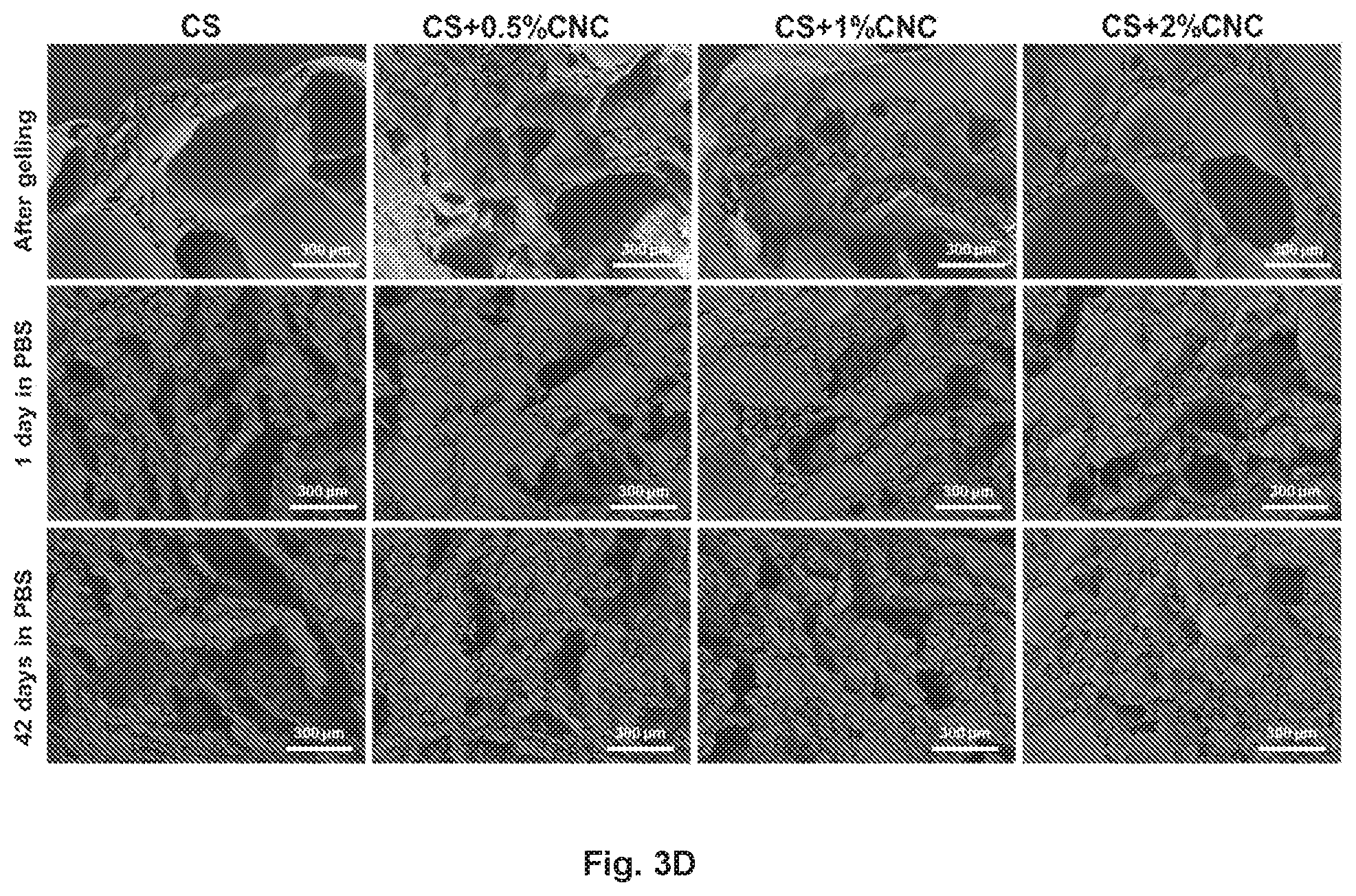 Patent US12377149 Figure 6 – Injectable thermoresponsive hydrogels as a combinatory modality for controlled drug delivery, biomaterial implant and 3D printing bioink