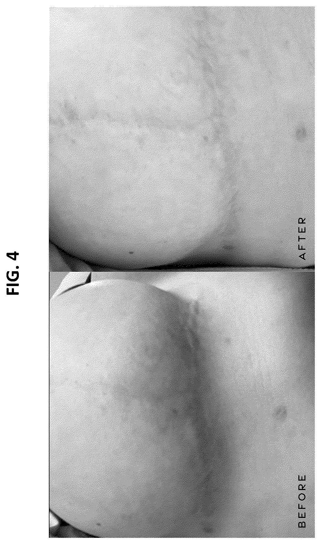 Patent US12377156 Figure 3 – Compositions and methods for treatment of wounds and inflammatory skin conditions