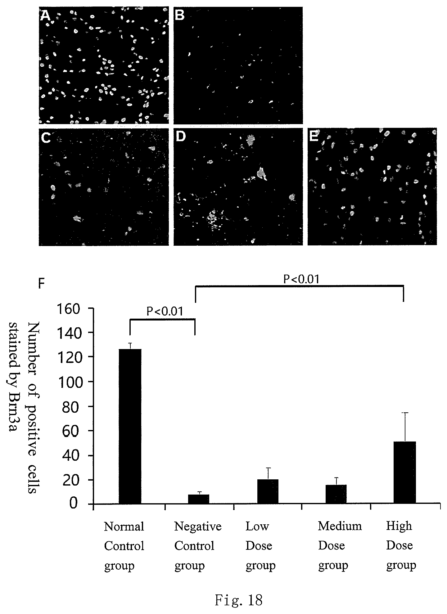 Patent US12377167 Figure 14 – Application of AuCs or substances containing AuCs in the preparation of drugs for preventing and/or treating glaucoma