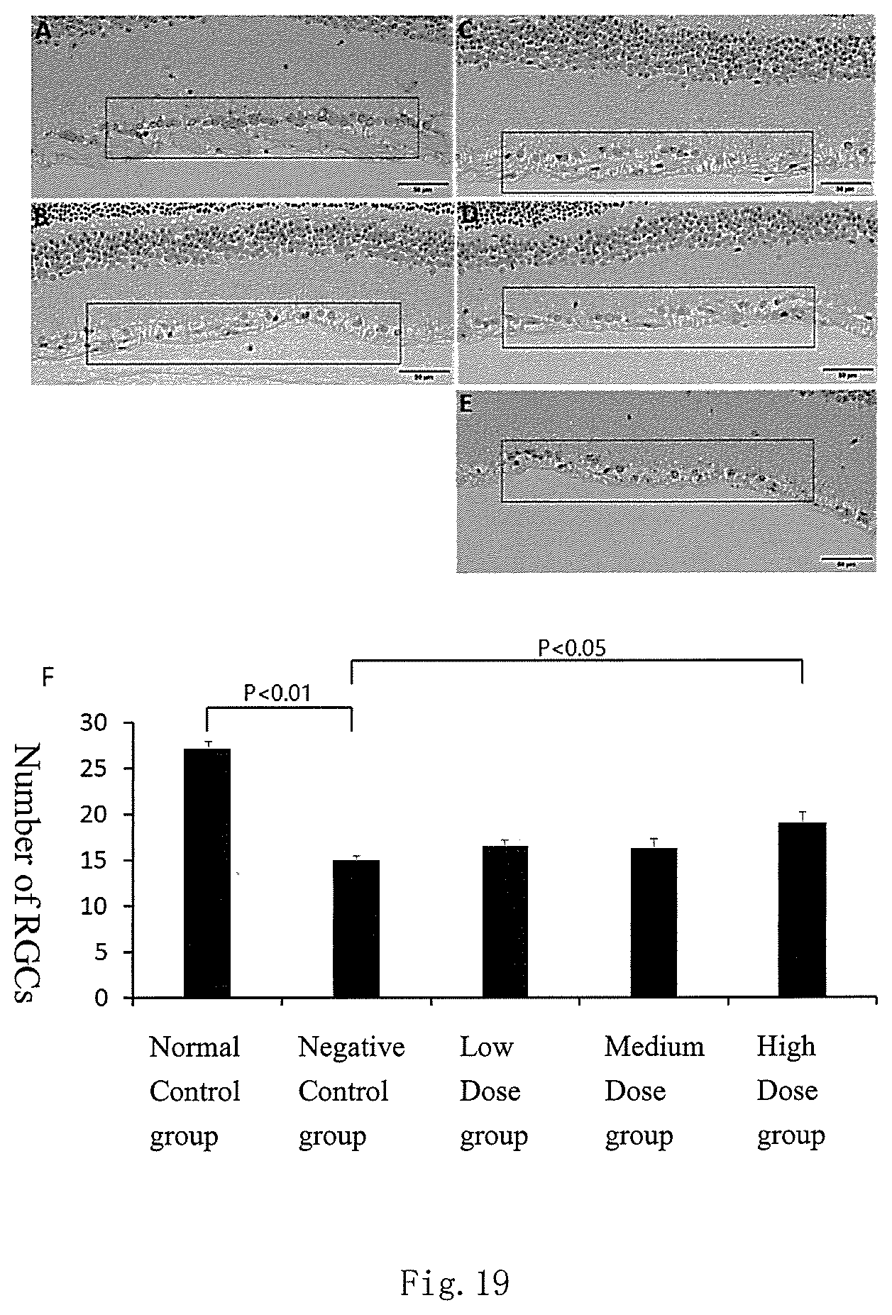 Patent US12377167 Figure 15 – Application of AuCs or substances containing AuCs in the preparation of drugs for preventing and/or treating glaucoma