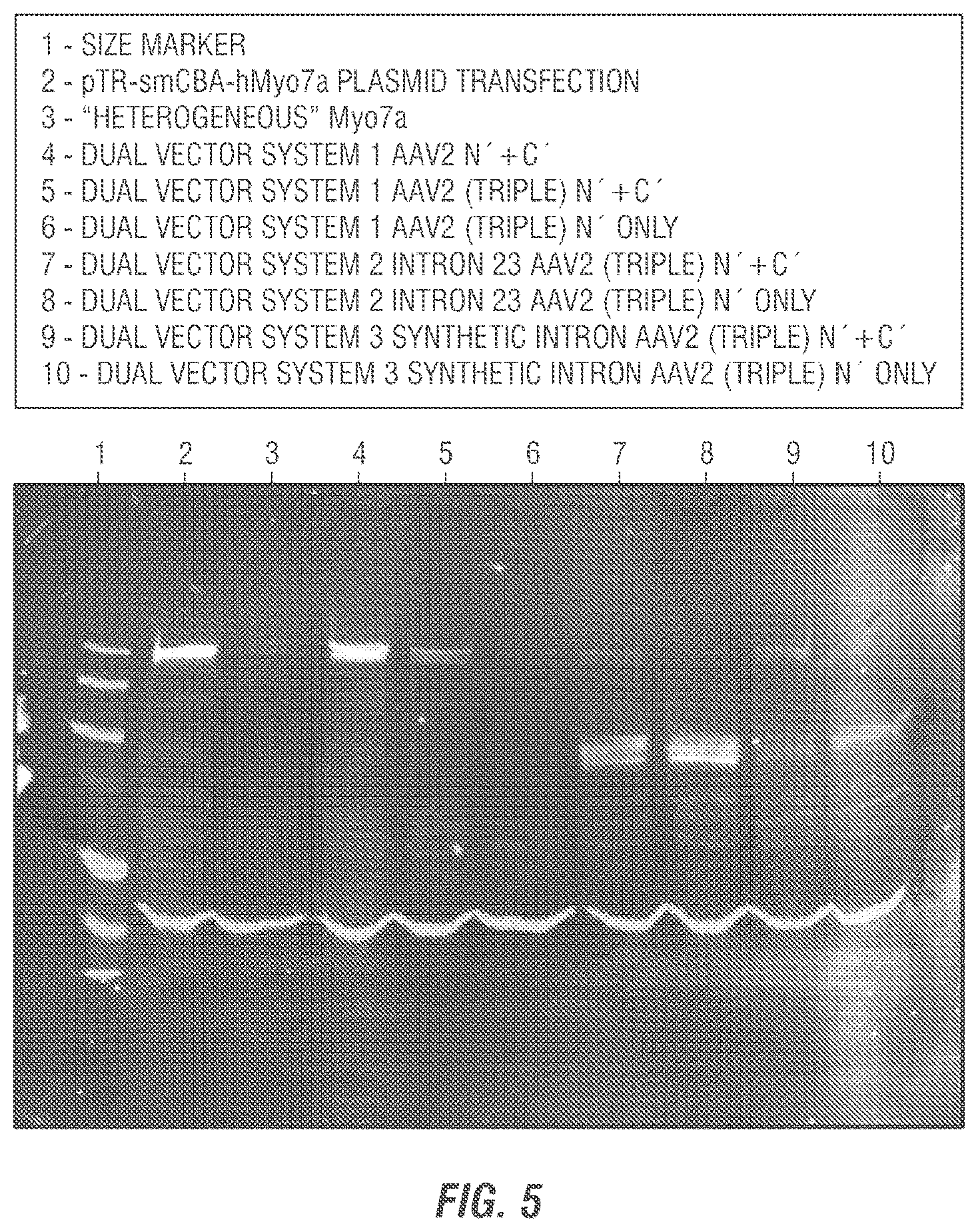 Patent US12377169 Figure 2 – Dual AAV-MYO7A vectors with improved safety for the treatment of USH1B