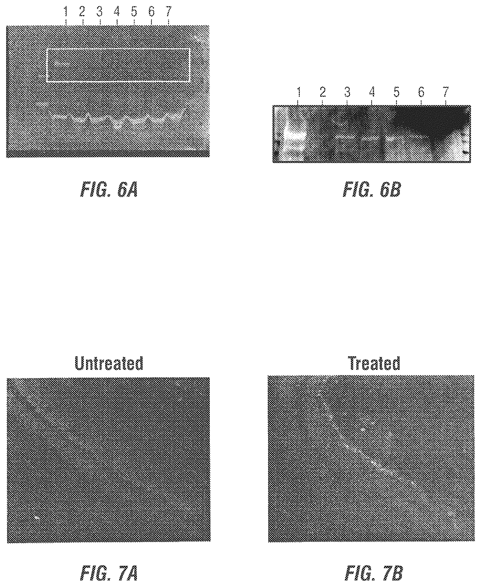 Patent US12377169 Figure 3 – Dual AAV-MYO7A vectors with improved safety for the treatment of USH1B