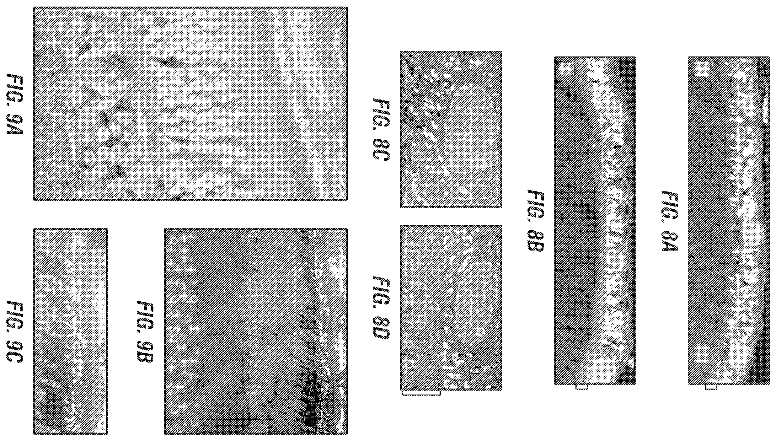 Patent US12377169 Figure 4 – Dual AAV-MYO7A vectors with improved safety for the treatment of USH1B
