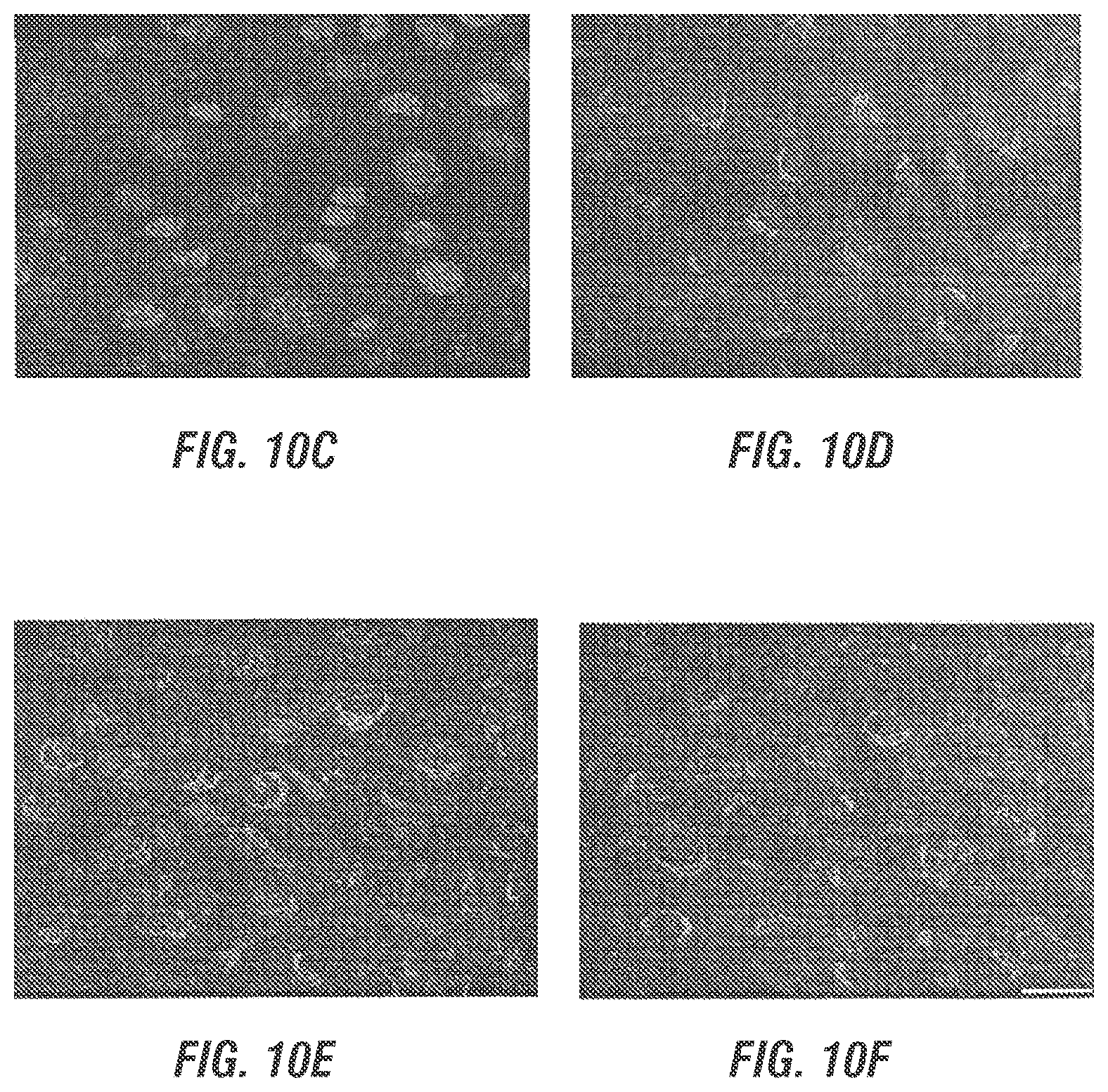Patent US12377169 Figure 6 – Dual AAV-MYO7A vectors with improved safety for the treatment of USH1B
