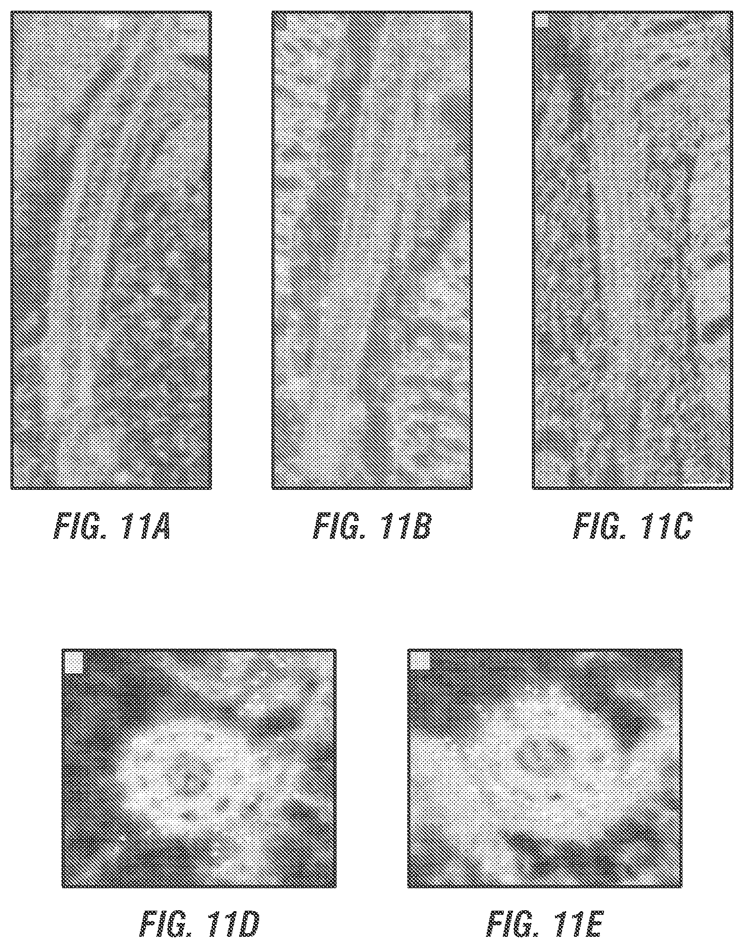Patent US12377169 Figure 7 – Dual AAV-MYO7A vectors with improved safety for the treatment of USH1B