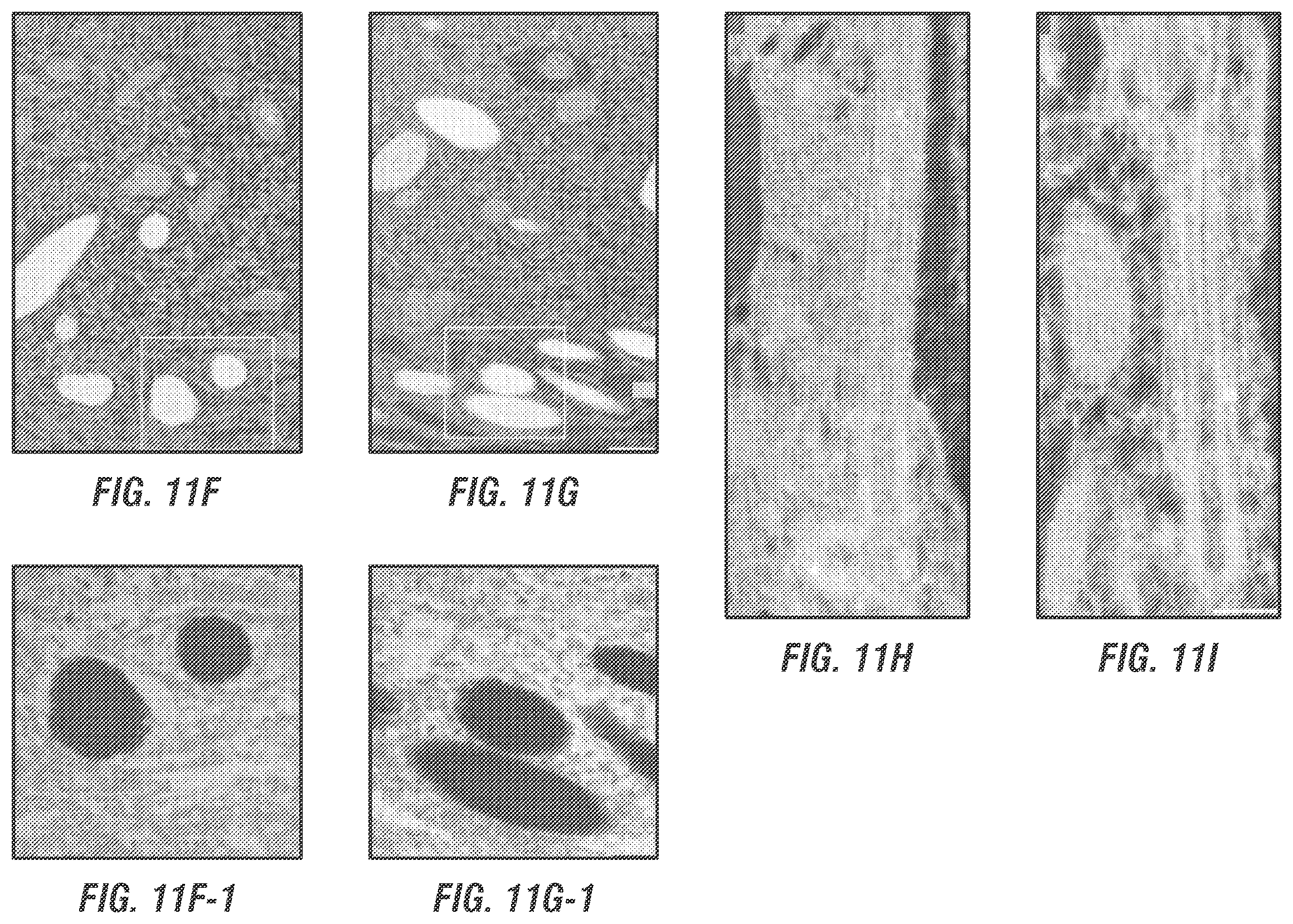 Patent US12377169 Figure 8 – Dual AAV-MYO7A vectors with improved safety for the treatment of USH1B