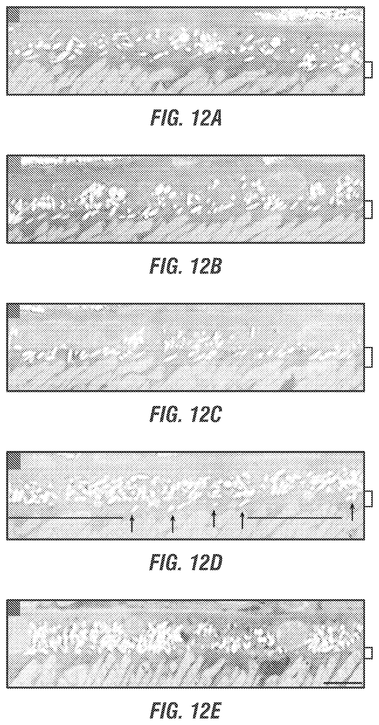 Patent US12377169 Figure 10 – Dual AAV-MYO7A vectors with improved safety for the treatment of USH1B