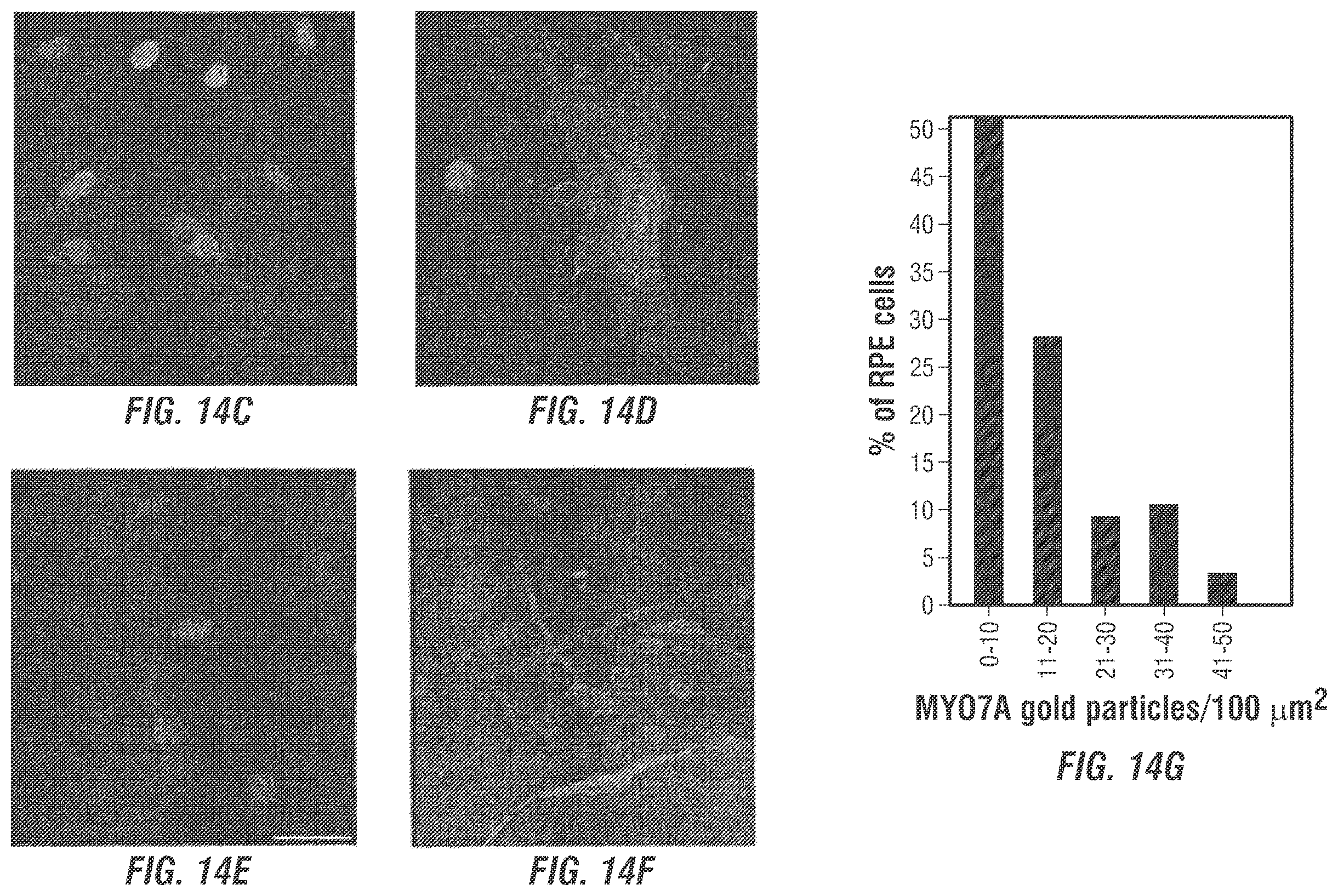 Patent US12377169 Figure 13 – Dual AAV-MYO7A vectors with improved safety for the treatment of USH1B
