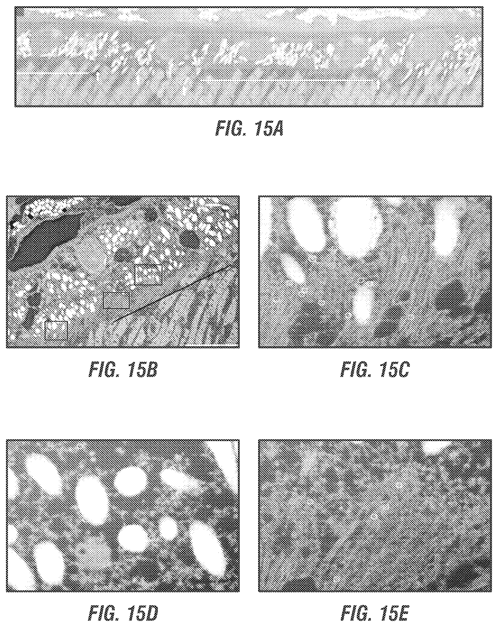 Patent US12377169 Figure 14 – Dual AAV-MYO7A vectors with improved safety for the treatment of USH1B