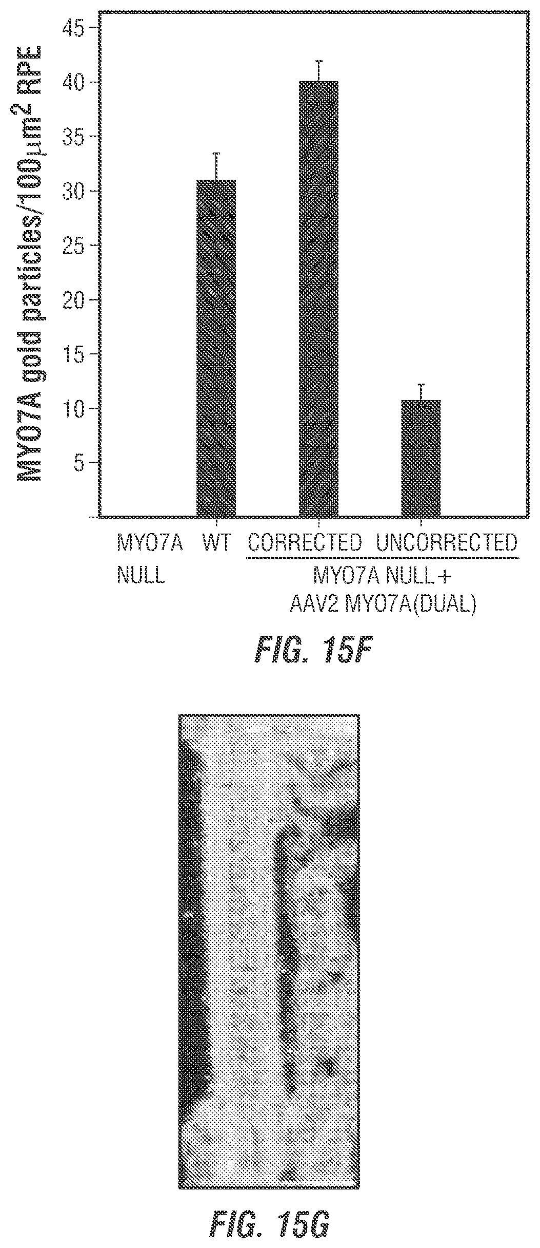 Patent US12377169 Figure 15 – Dual AAV-MYO7A vectors with improved safety for the treatment of USH1B