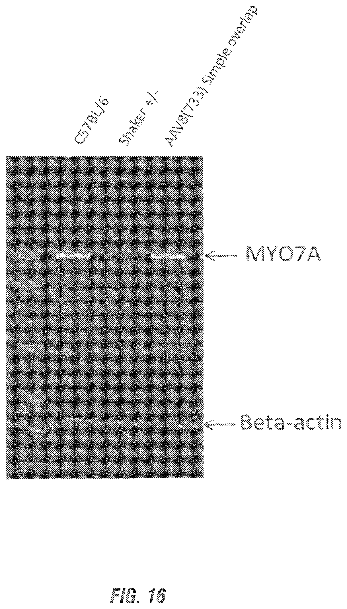 Patent US12377169 Figure 16 – Dual AAV-MYO7A vectors with improved safety for the treatment of USH1B