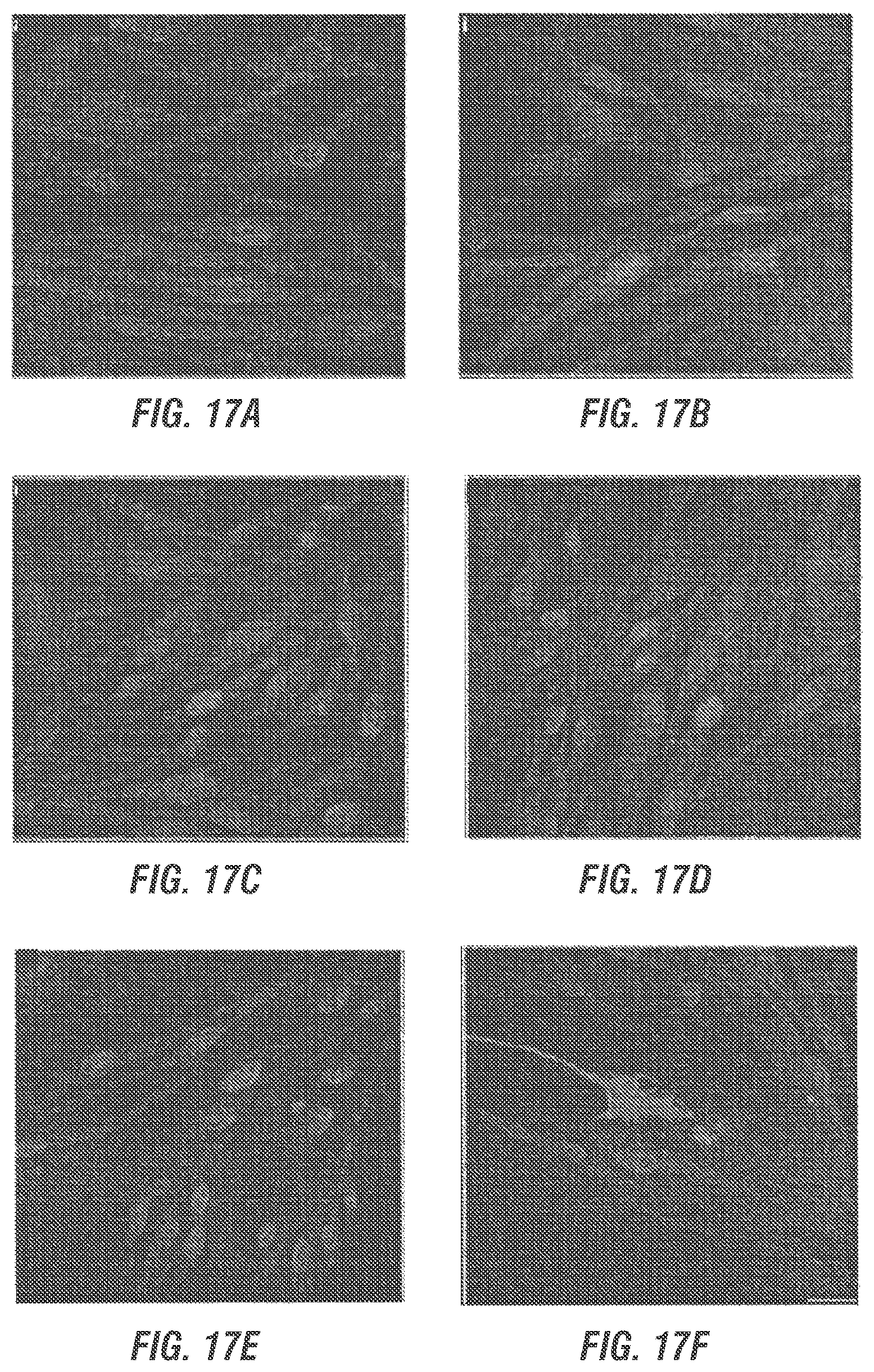 Patent US12377169 Figure 17 – Dual AAV-MYO7A vectors with improved safety for the treatment of USH1B