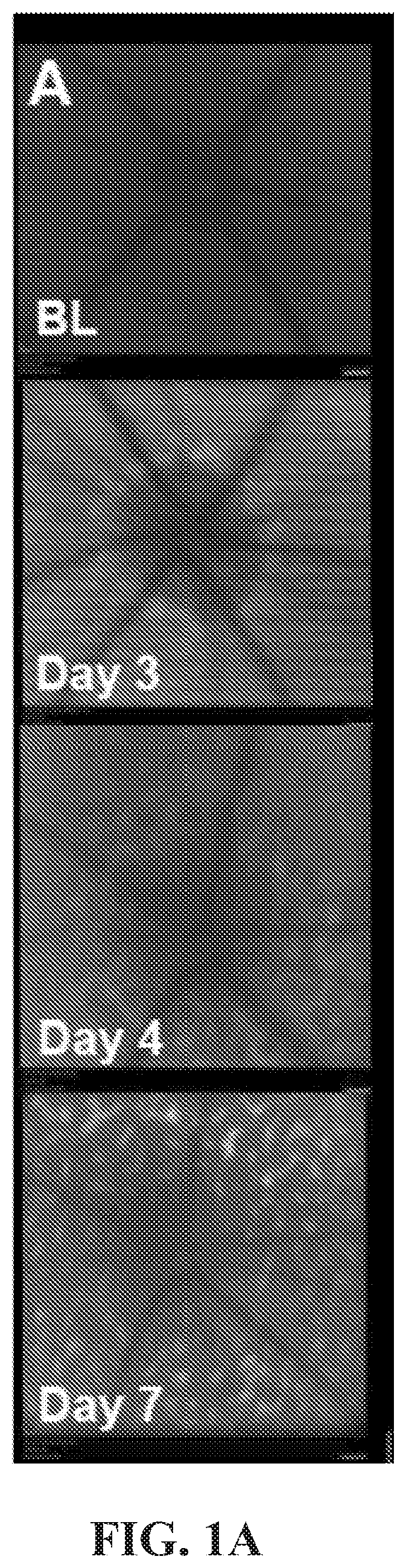 Patent US12377171 — Methods for treating and diagnosing blinding eye diseases — Figure 1