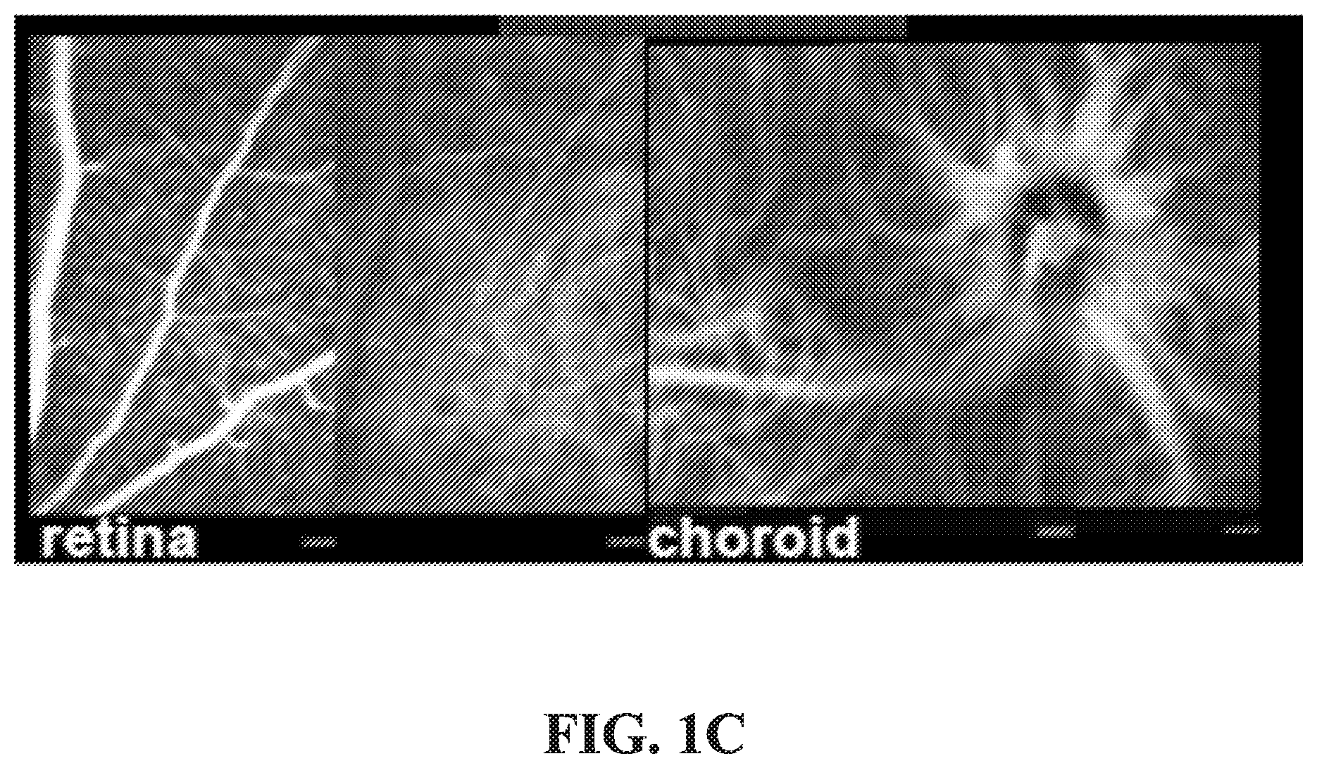 Patent US12377171 Figure 3 – Methods for treating and diagnosing blinding eye diseases