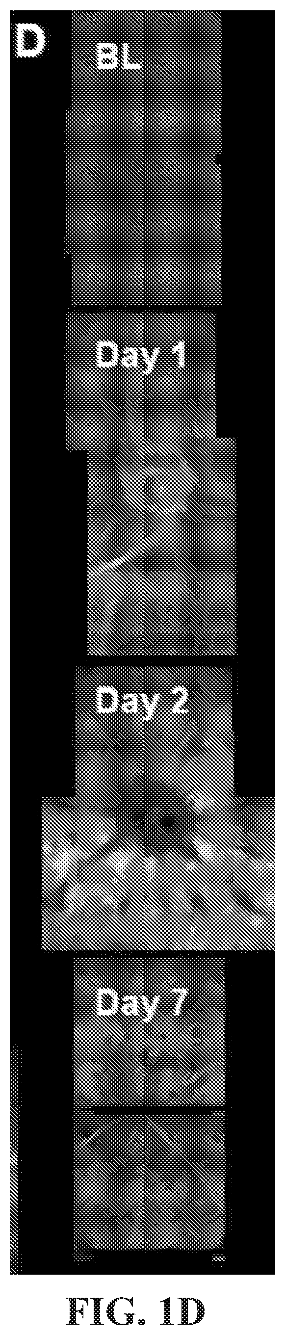 Patent US12377171 Figure 4 – Methods for treating and diagnosing blinding eye diseases