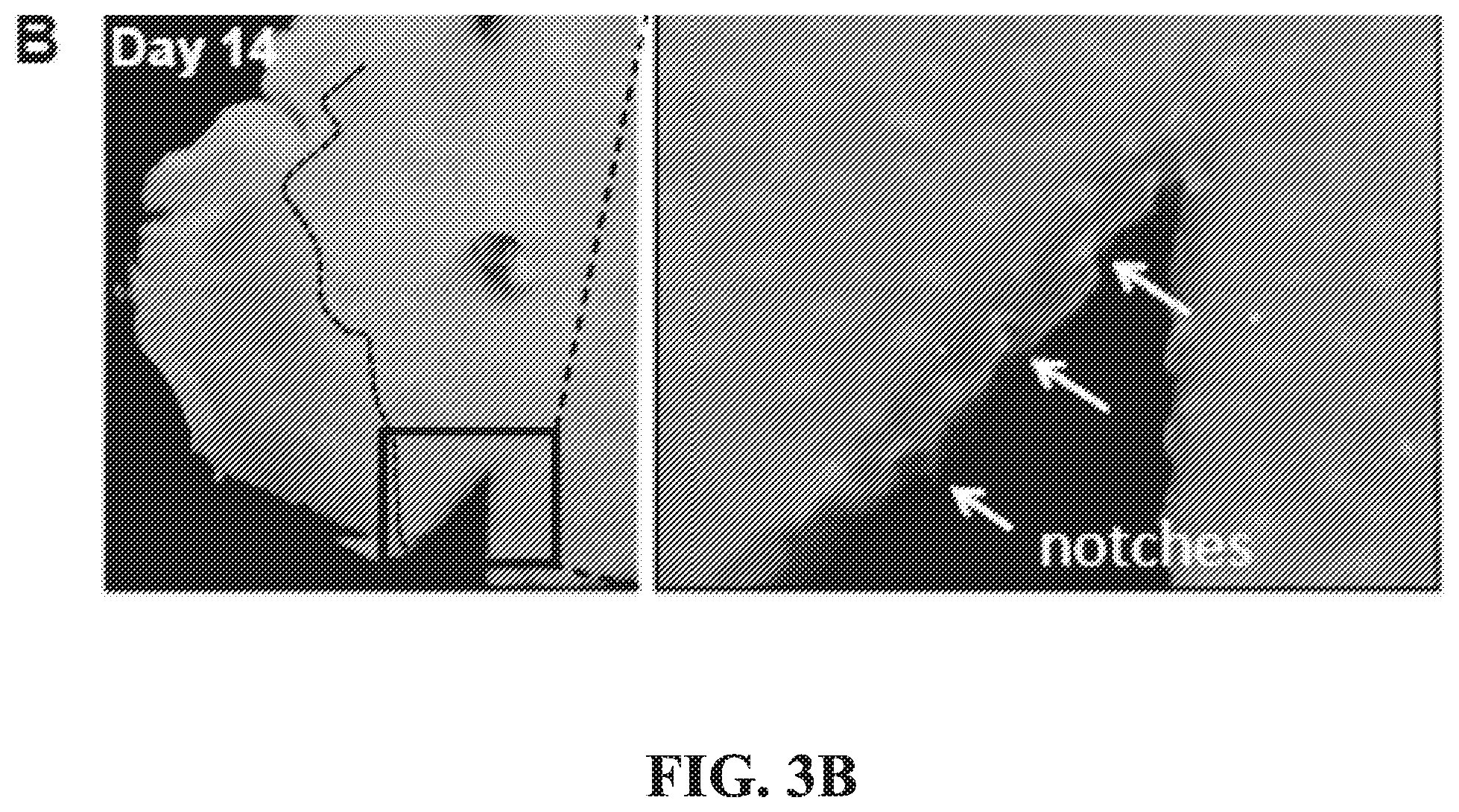 Patent US12377171 Figure 9 – Methods for treating and diagnosing blinding eye diseases