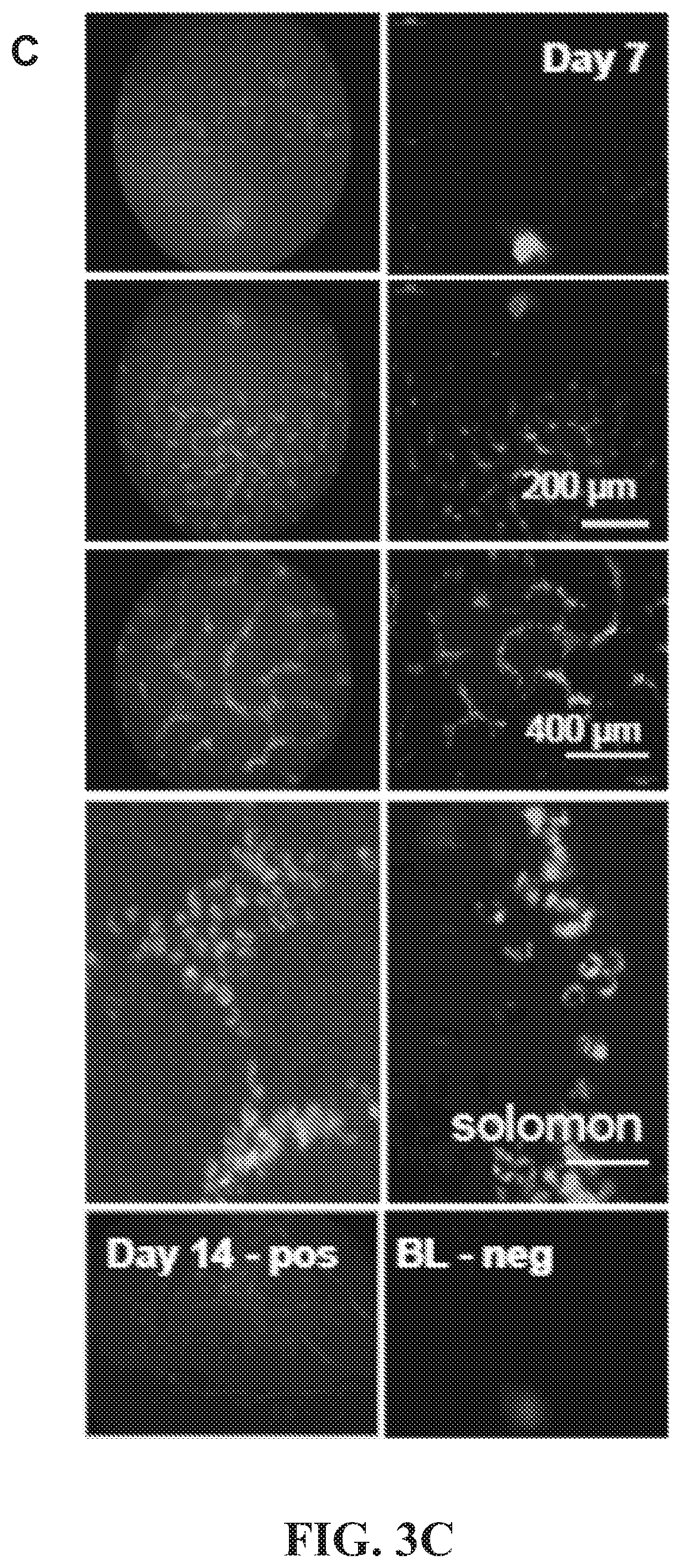 Patent US12377171 Figure 10 – Methods for treating and diagnosing blinding eye diseases