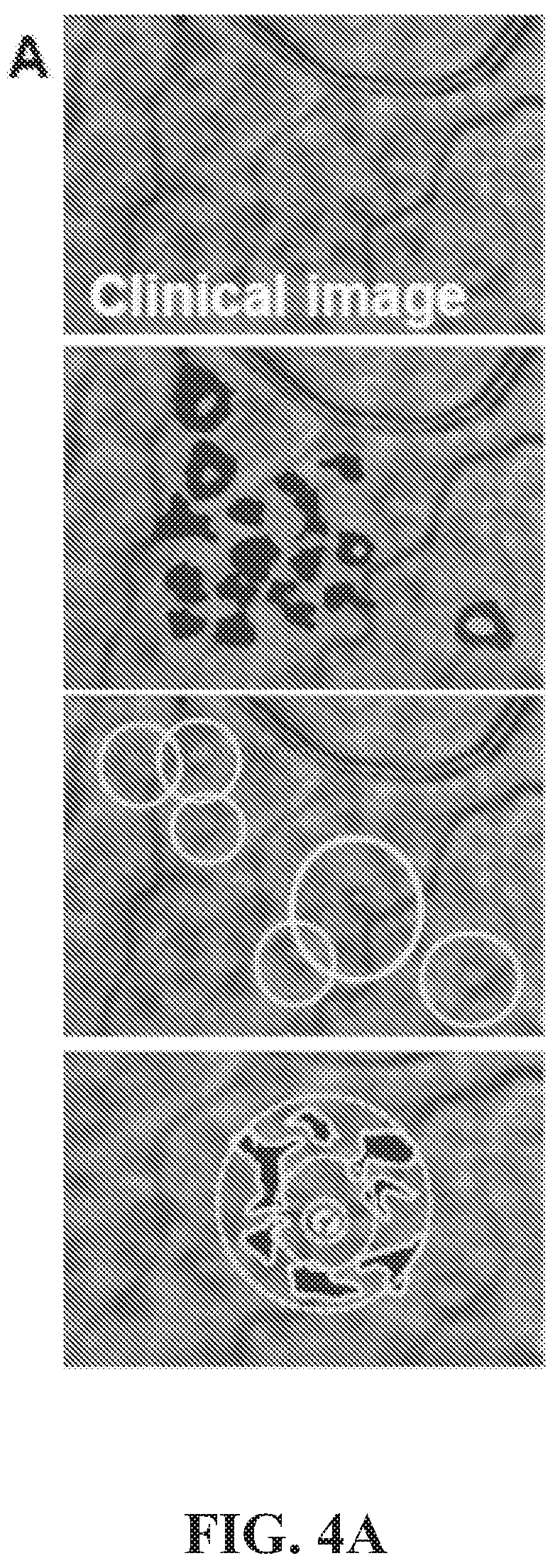 Patent US12377171 Figure 11 – Methods for treating and diagnosing blinding eye diseases