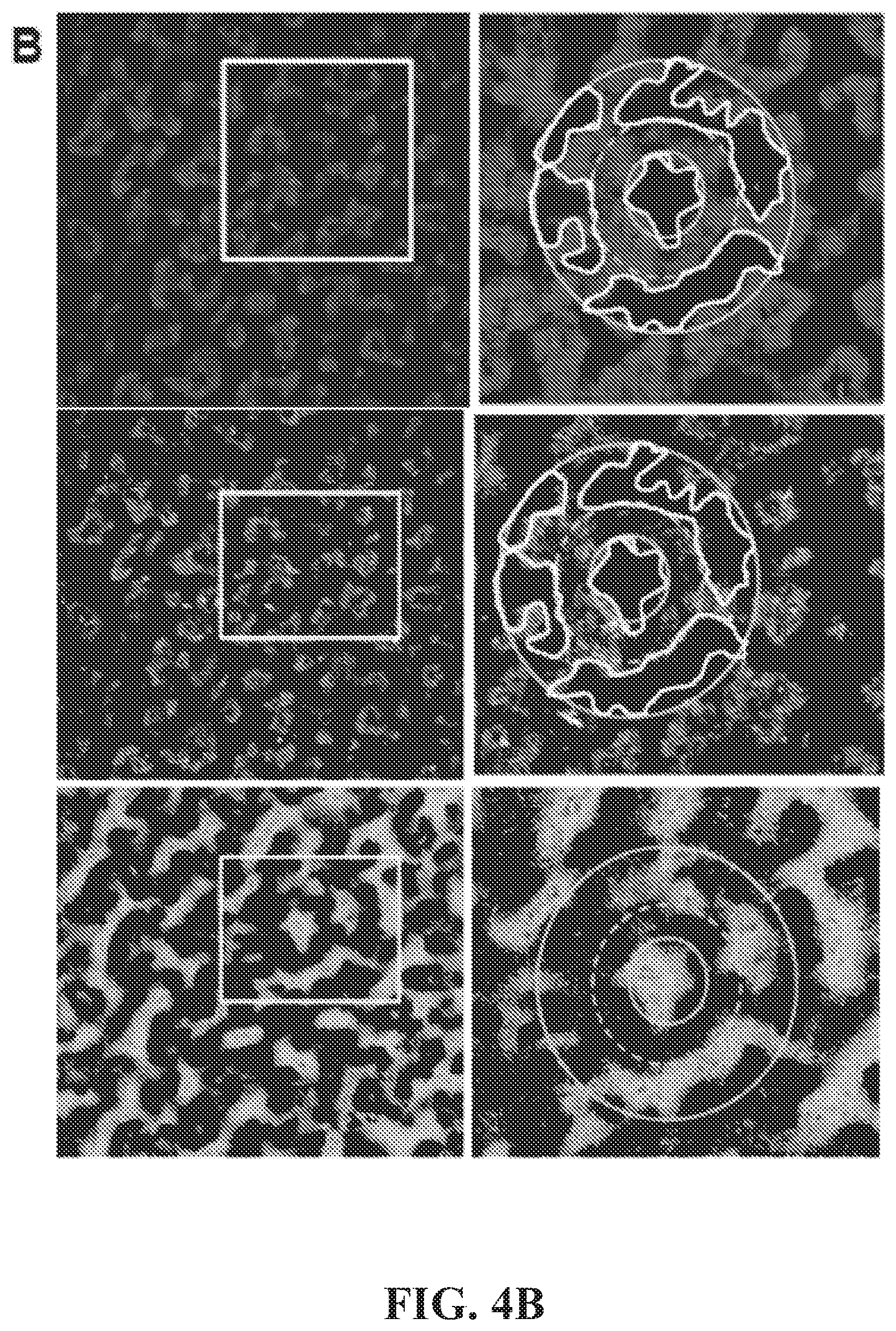 Patent US12377171 Figure 12 – Methods for treating and diagnosing blinding eye diseases