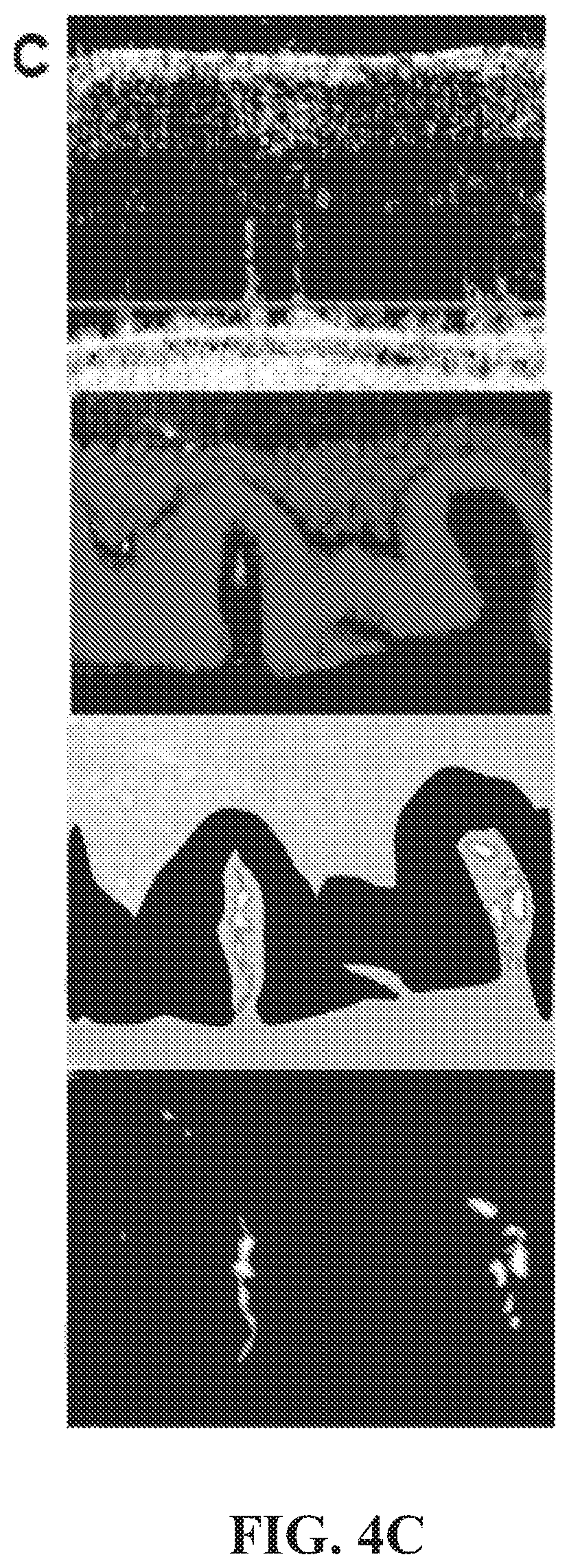 Patent US12377171 Figure 13 – Methods for treating and diagnosing blinding eye diseases