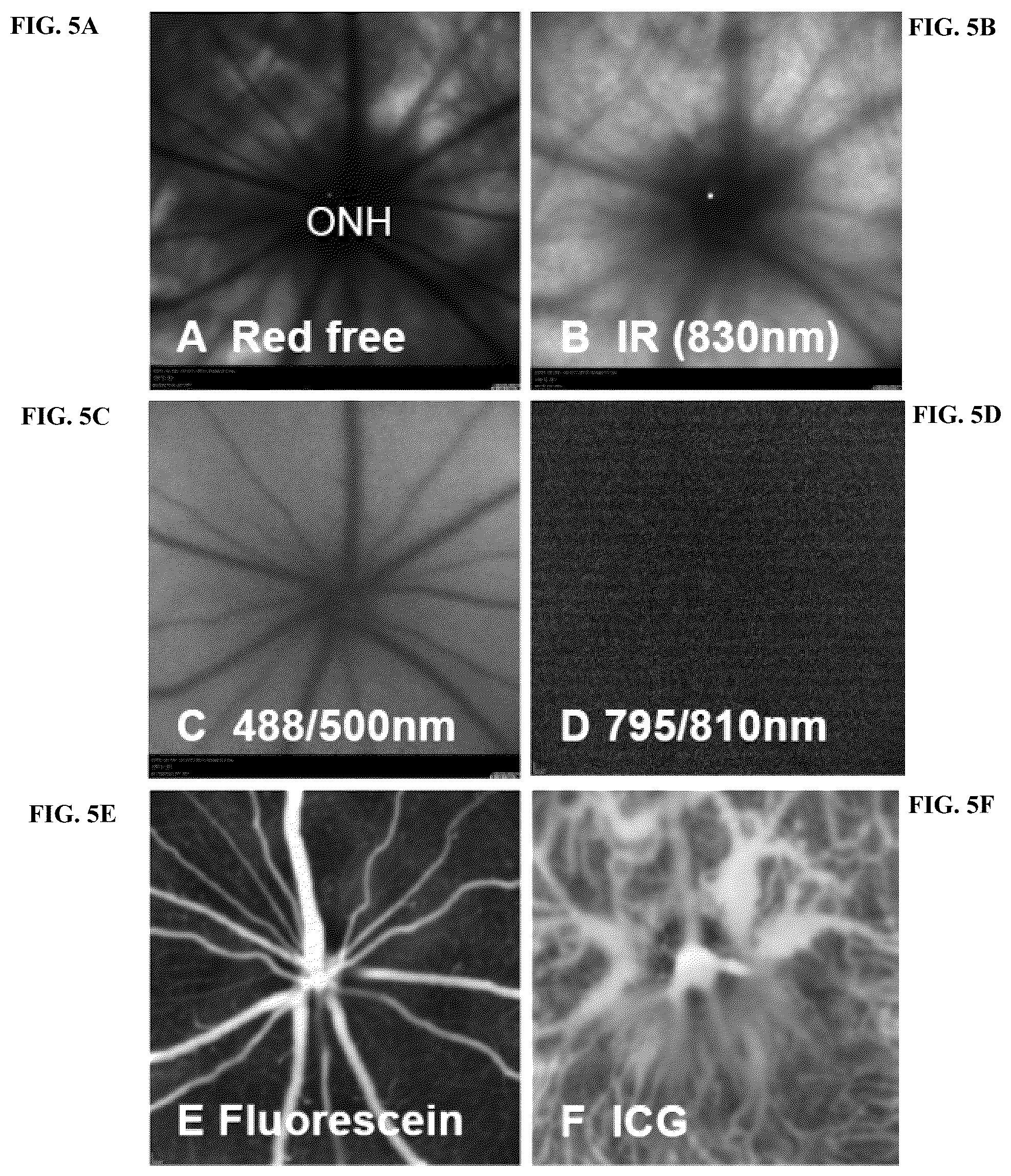 Patent US12377171 Figure 14 – Methods for treating and diagnosing blinding eye diseases