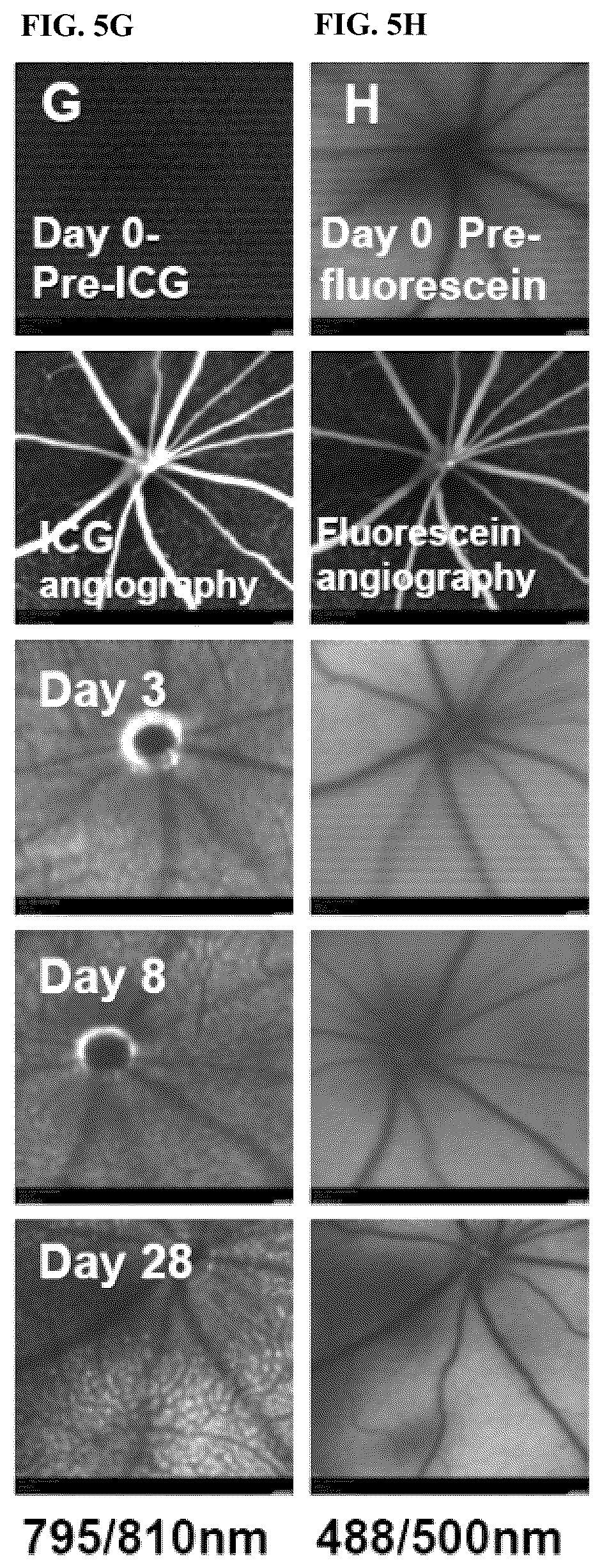 Patent US12377171 Figure 15 – Methods for treating and diagnosing blinding eye diseases