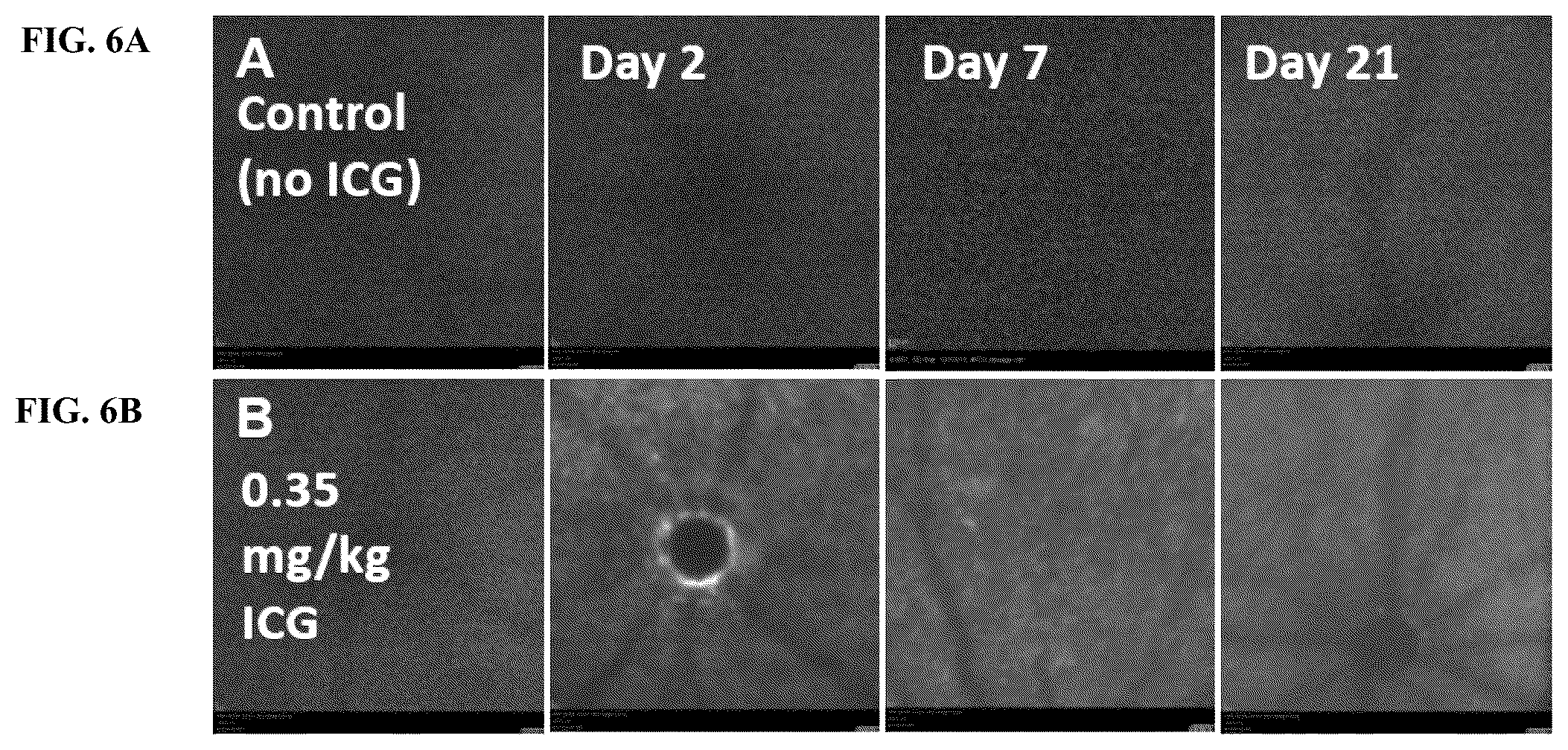 Patent US12377171 Figure 16 – Methods for treating and diagnosing blinding eye diseases