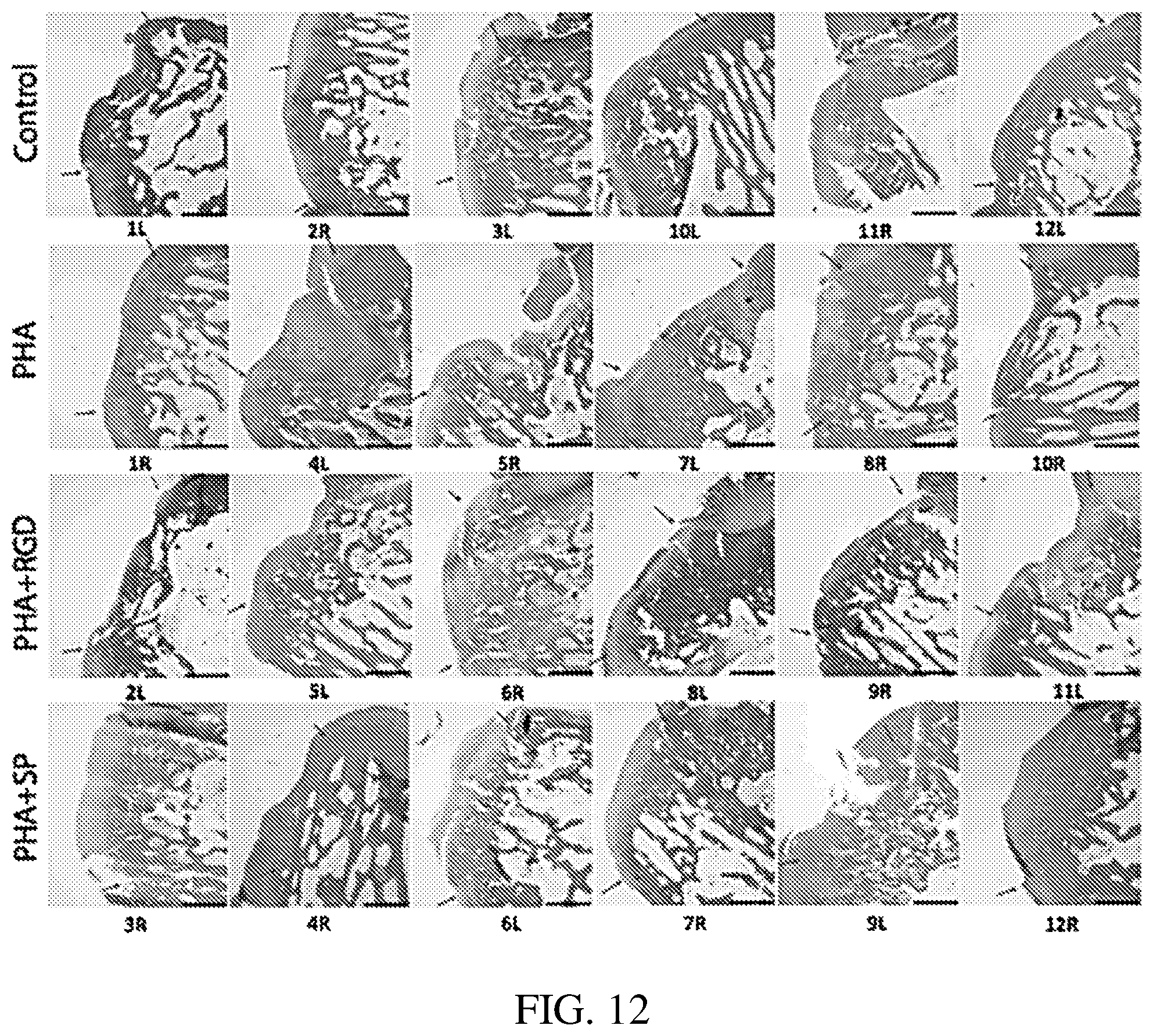 Patent US12377191 Figure 8 – Chondroinductive peptides and compositions and methods of use thereof