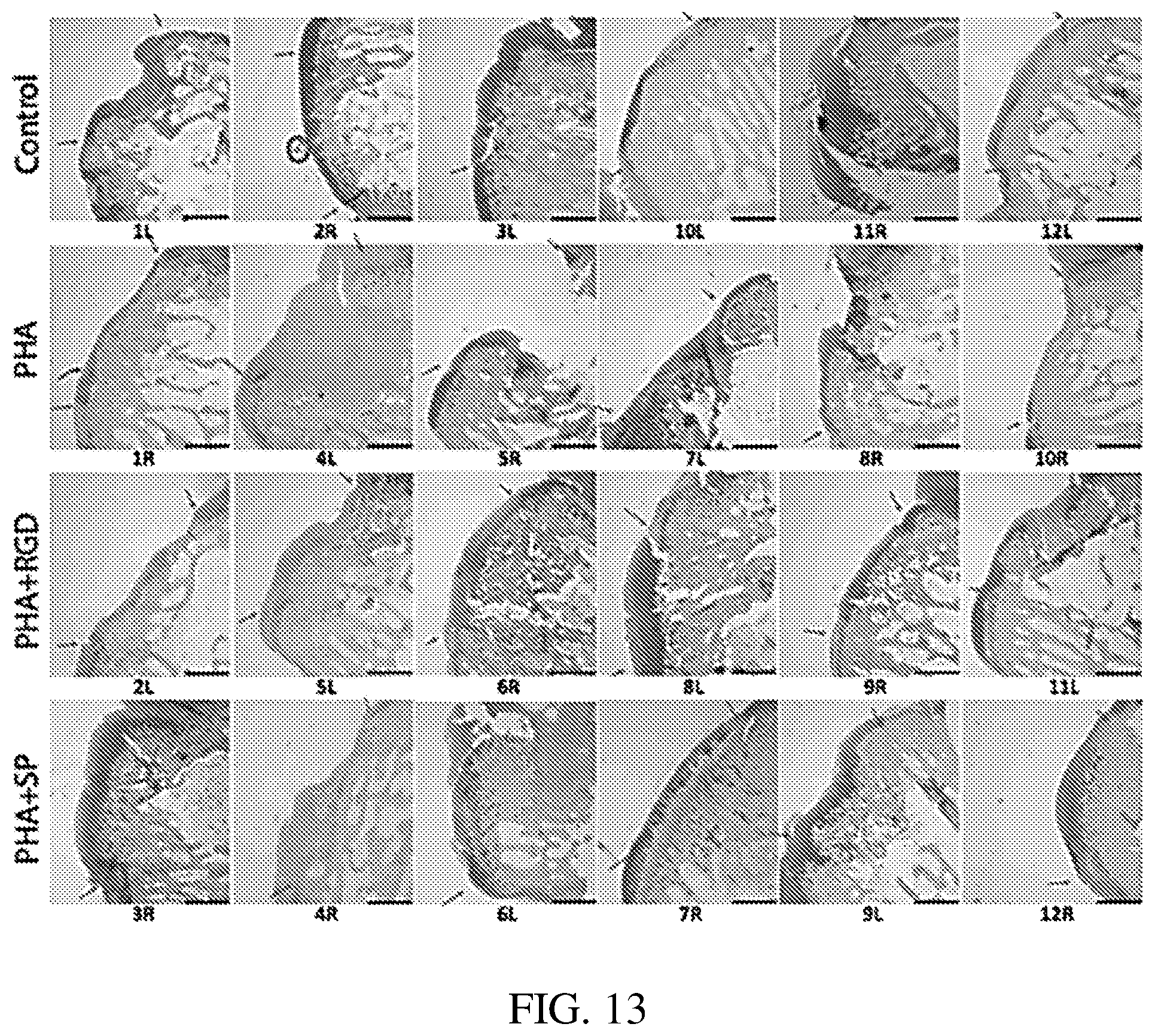 Patent US12377191 Figure 9 – Chondroinductive peptides and compositions and methods of use thereof
