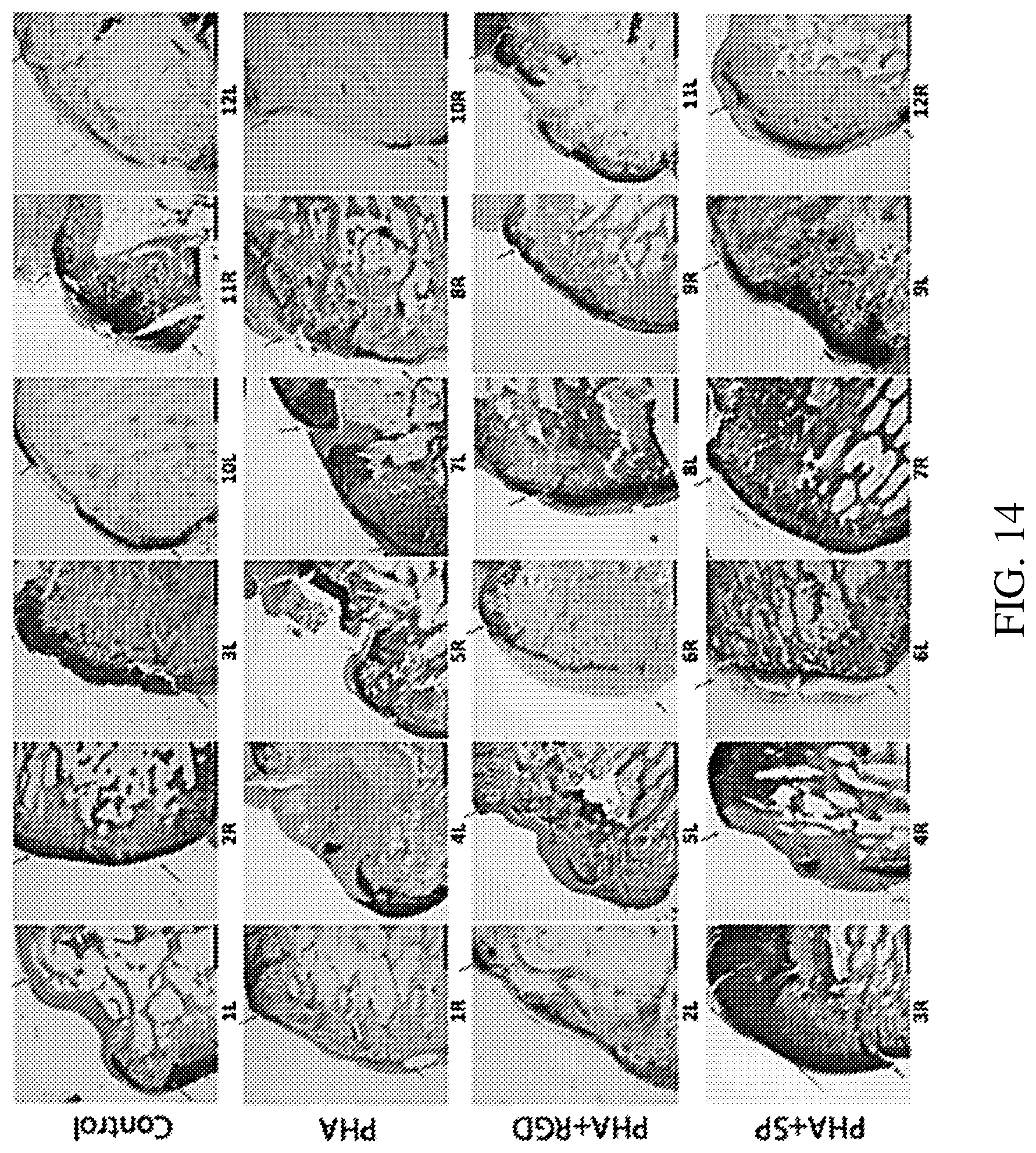Patent US12377191 Figure 10 – Chondroinductive peptides and compositions and methods of use thereof