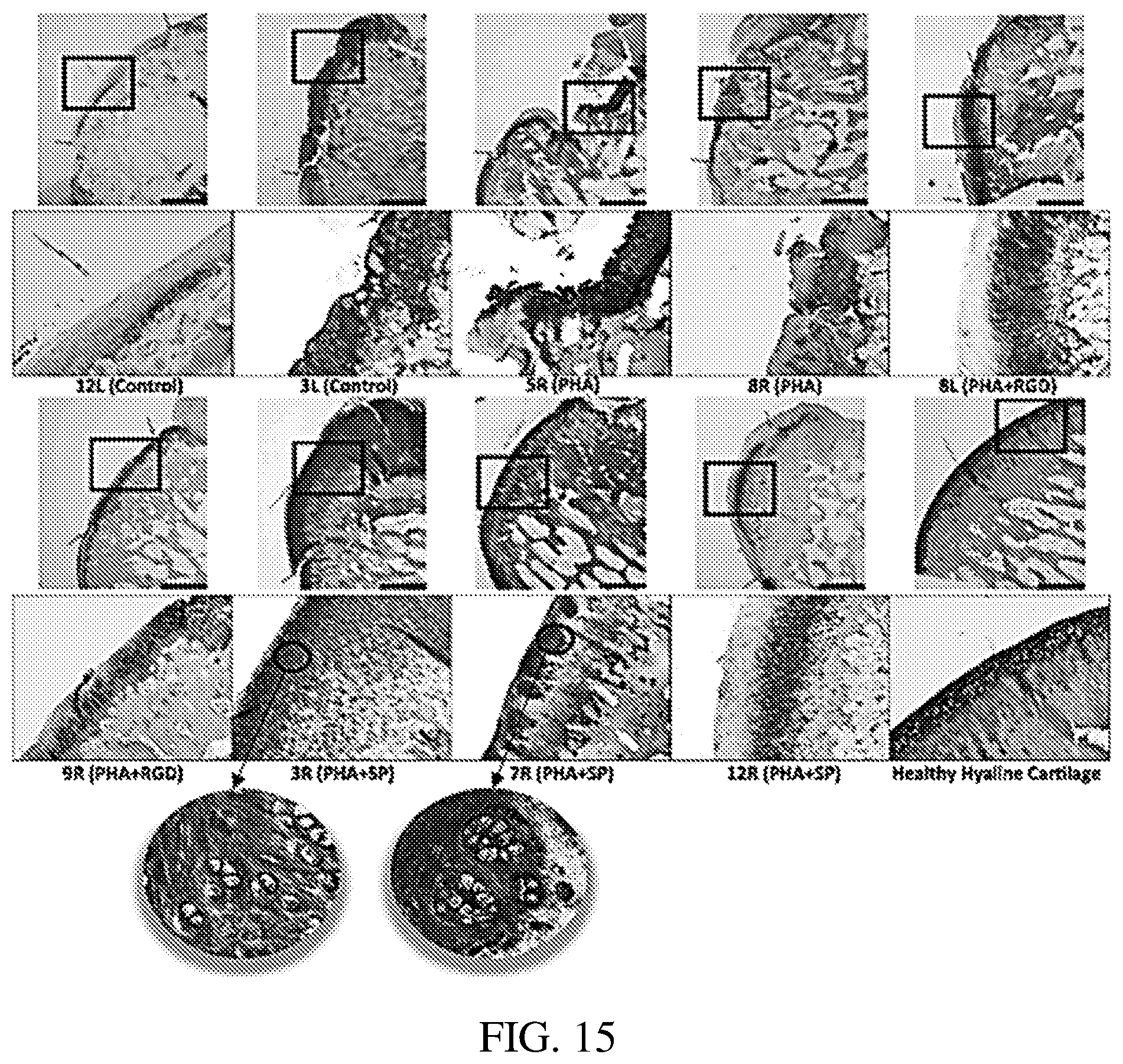 Patent US12377191 Figure 11 – Chondroinductive peptides and compositions and methods of use thereof