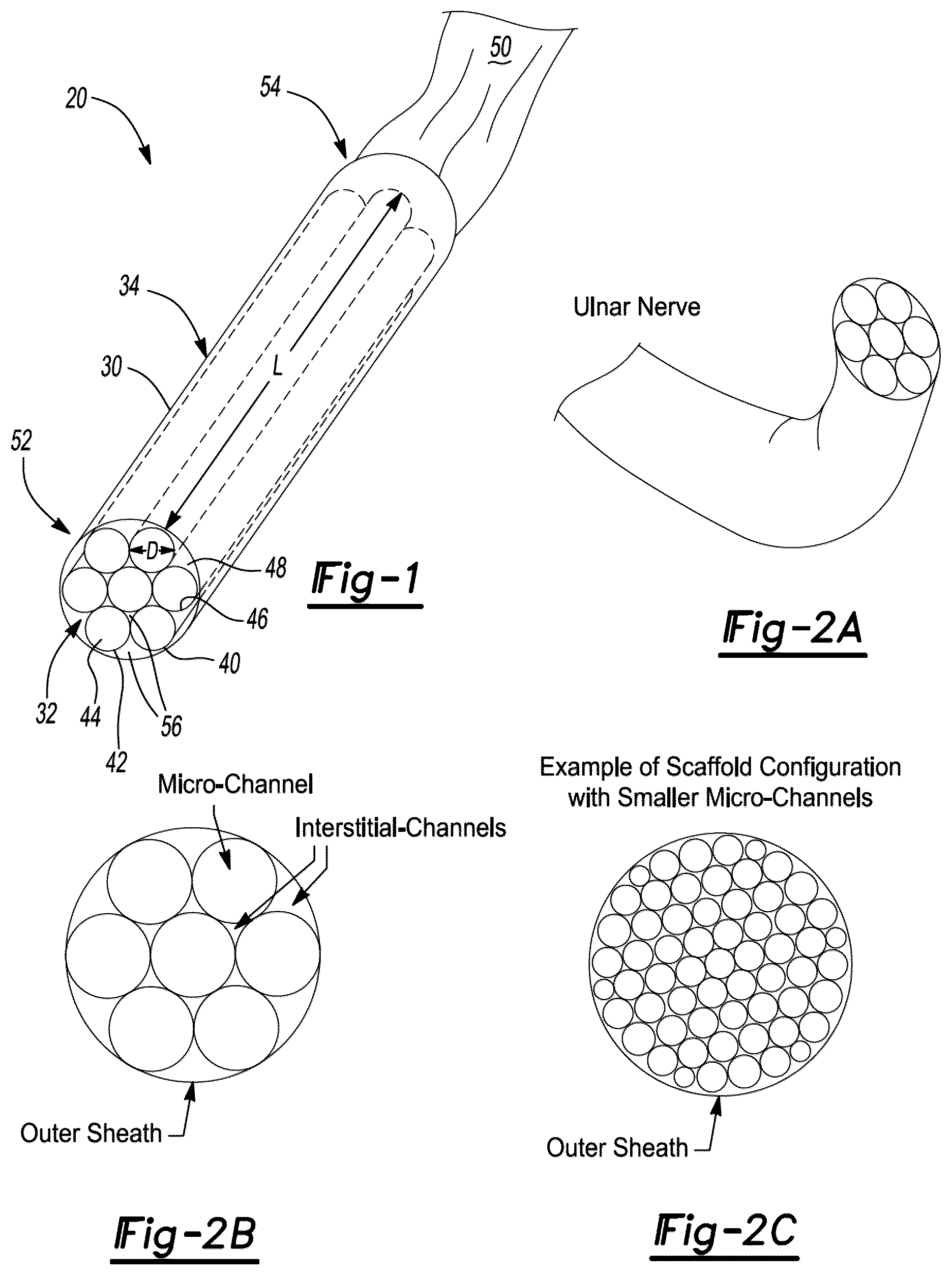 Patent US12377195 Figure 1 – Nerve repair scaffolds having high microchannel volume and methods for making the same