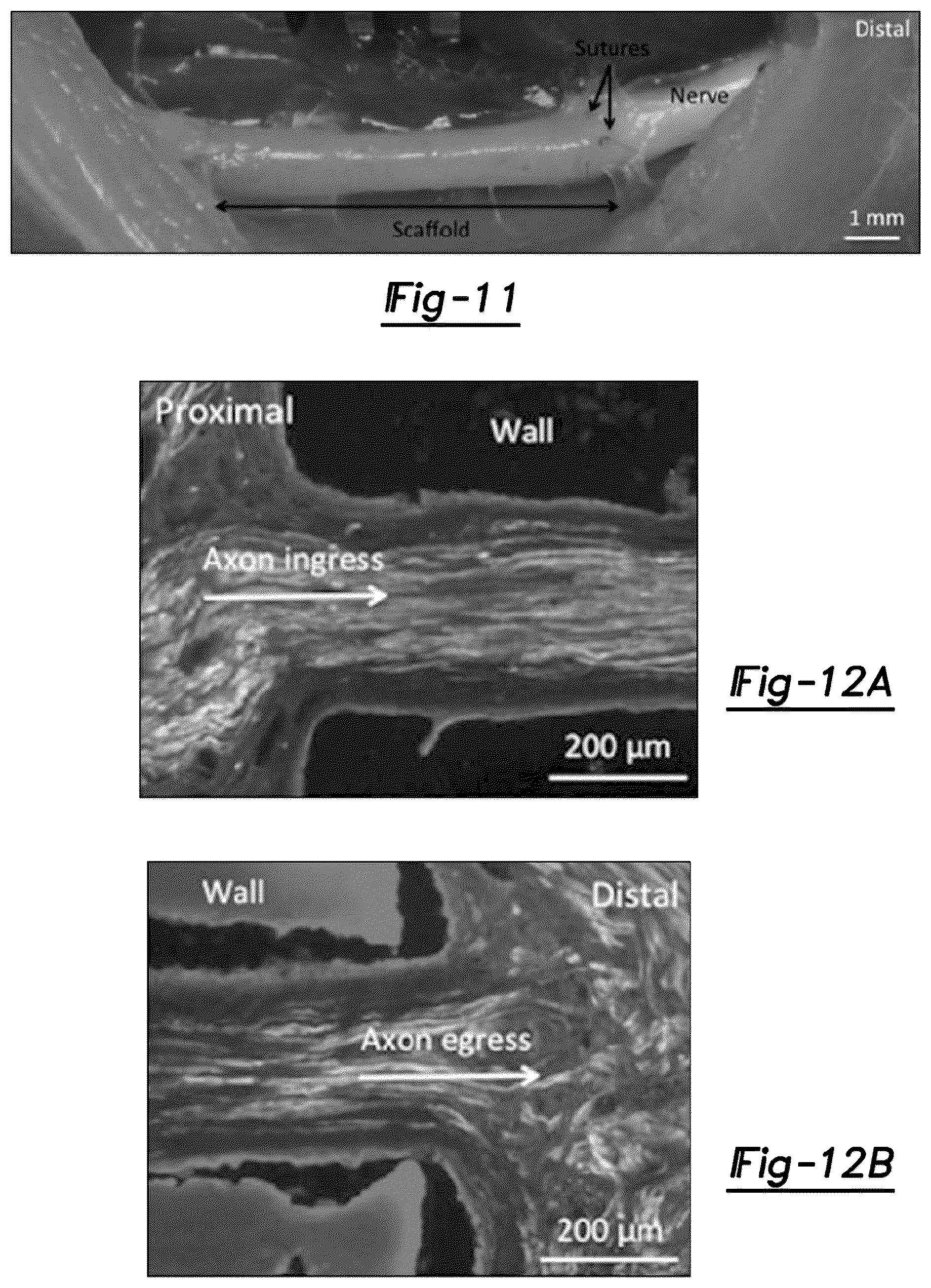 Patent US12377195 Figure 8 – Nerve repair scaffolds having high microchannel volume and methods for making the same