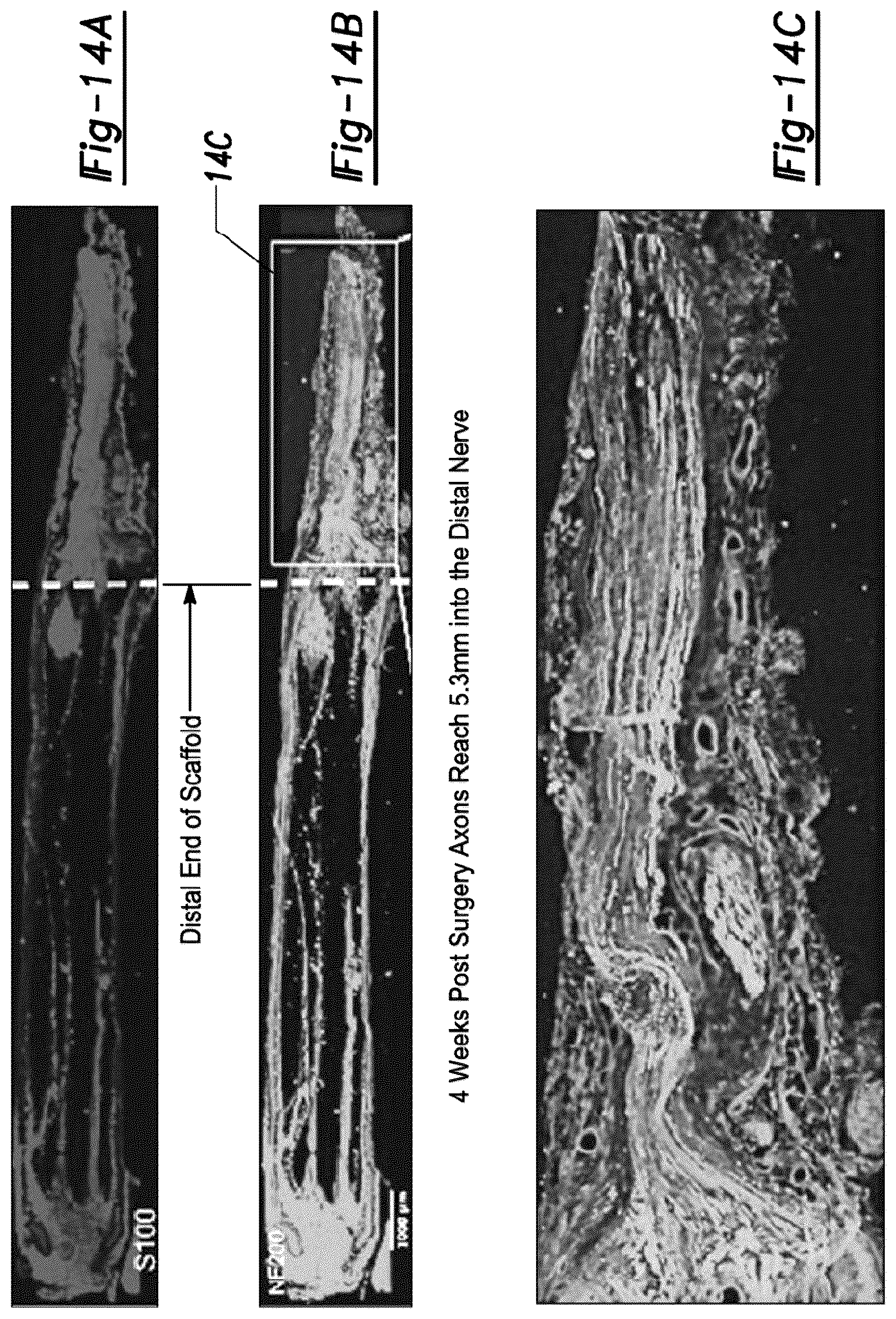 Patent US12377195 Figure 10 – Nerve repair scaffolds having high microchannel volume and methods for making the same