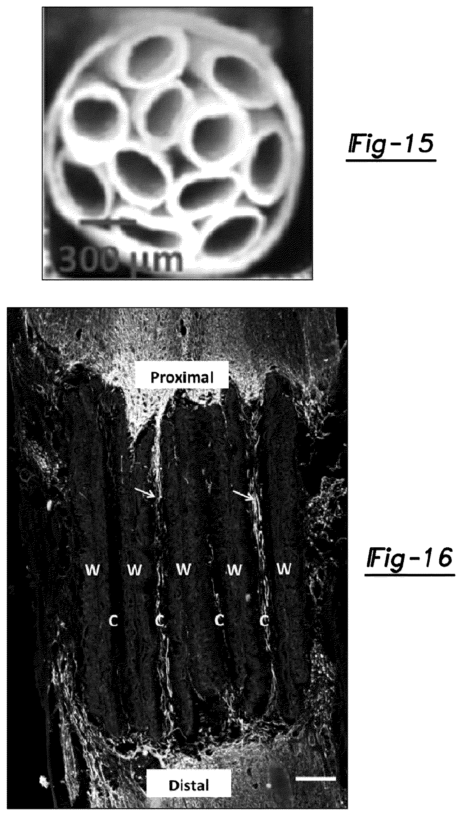 Patent US12377195 Figure 11 – Nerve repair scaffolds having high microchannel volume and methods for making the same